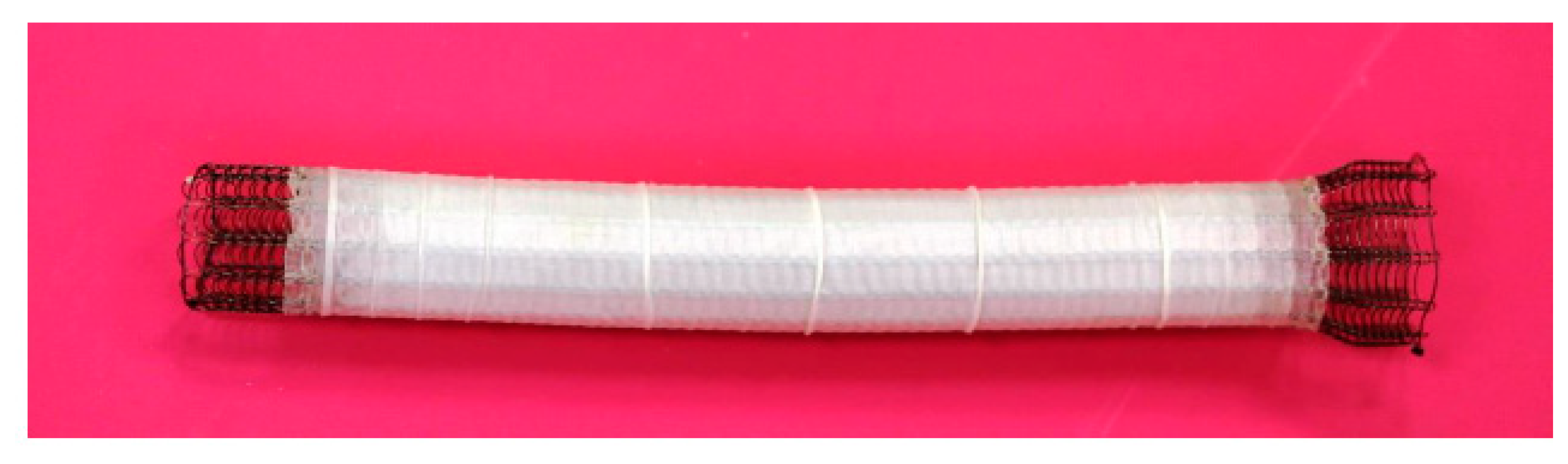 Gastrointestdisord 05 00032 g003 Gastrointestdisord 05 00032 g003