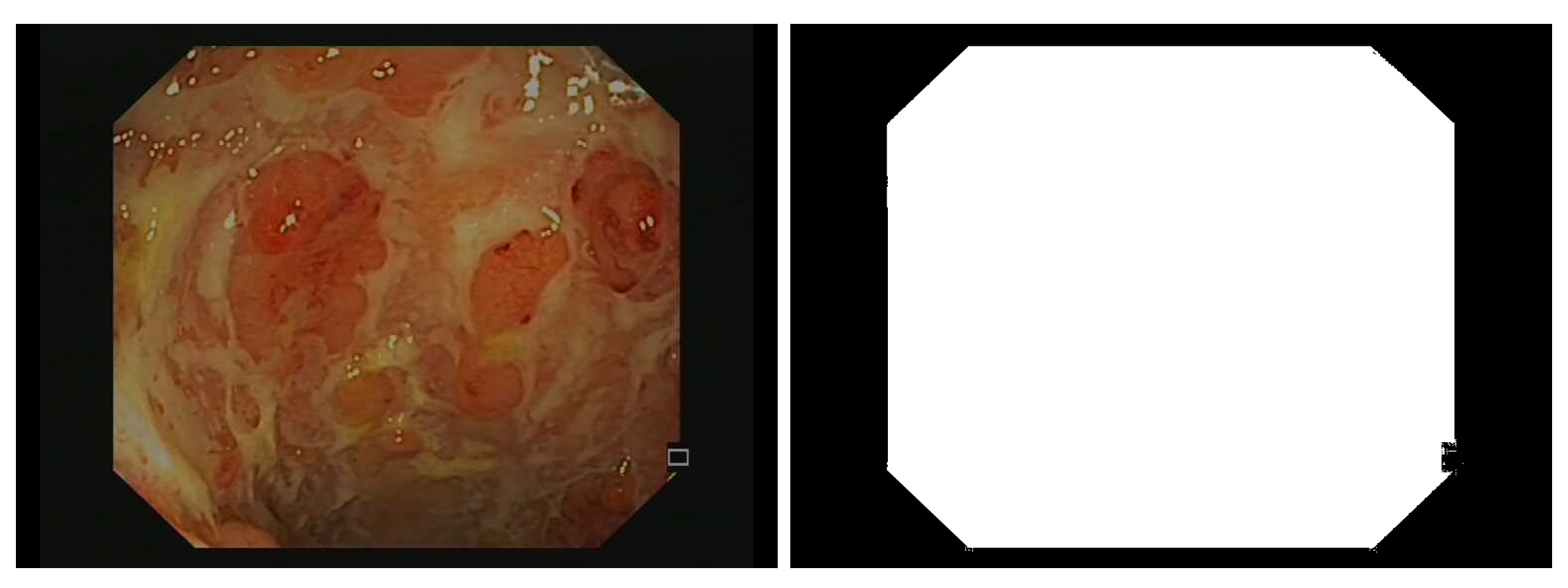 Gastrointestdisord 06 00020 g002