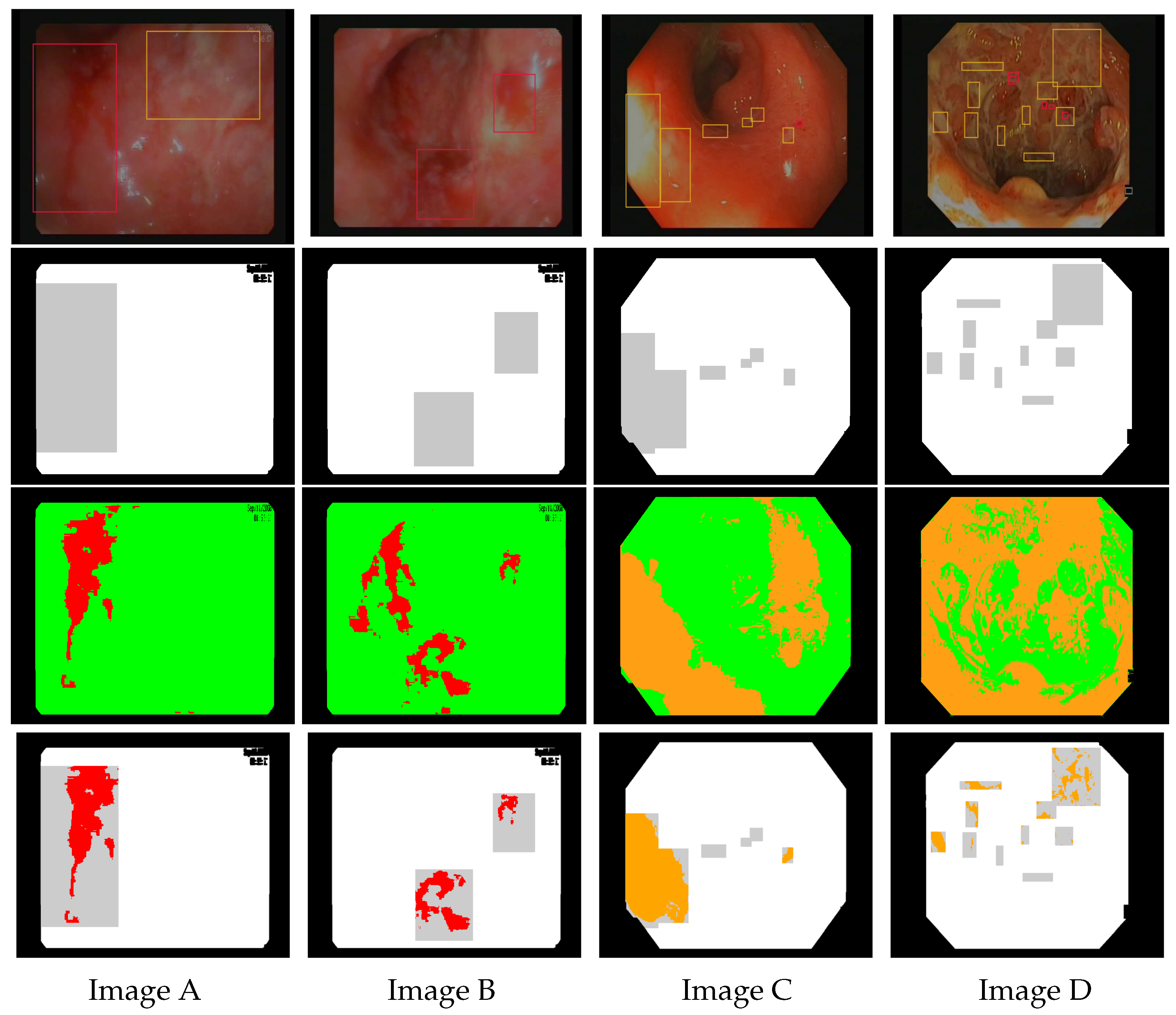 Gastrointestdisord 06 00020 g006