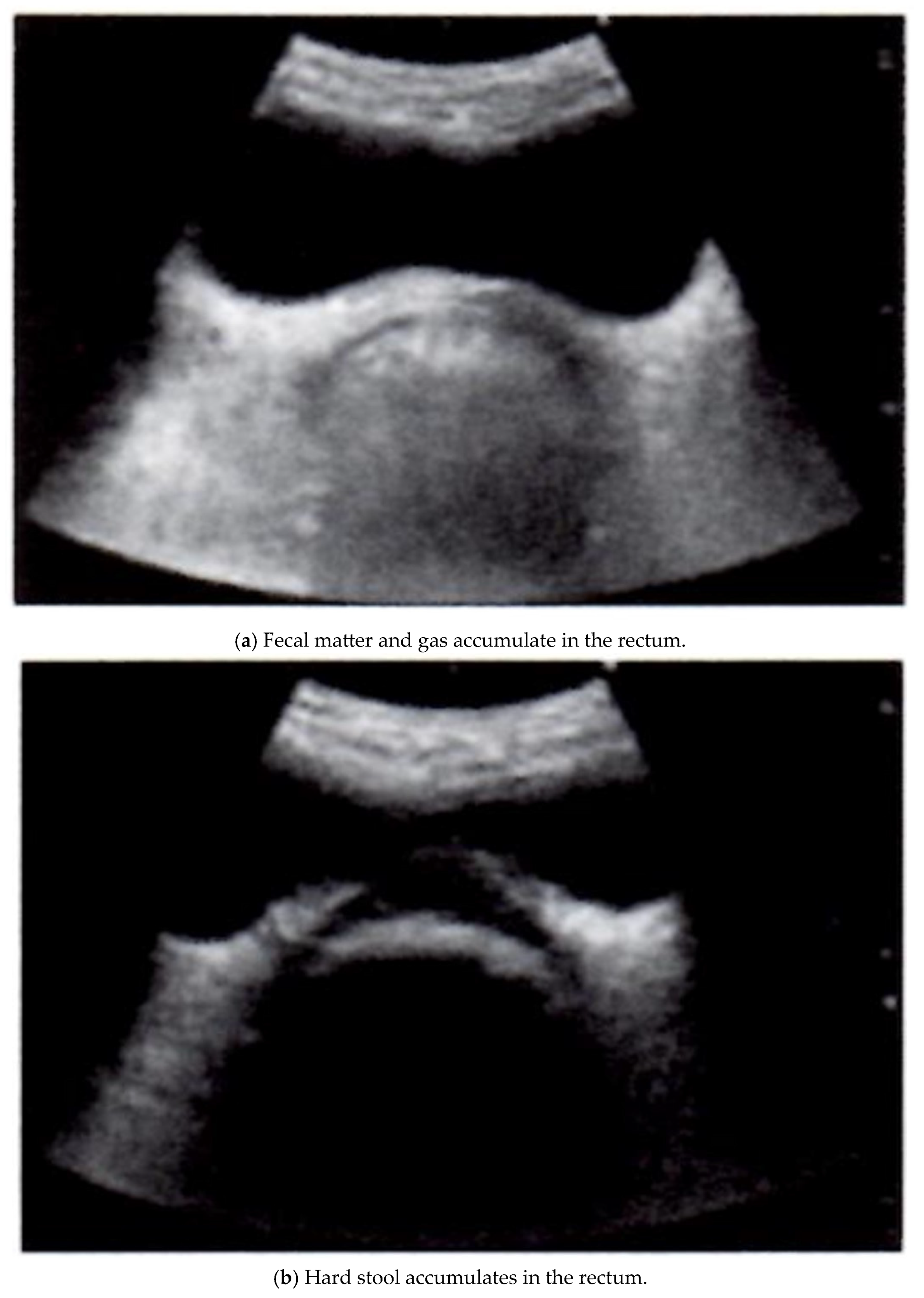 Gastrointestdisord 07 00012 g001a