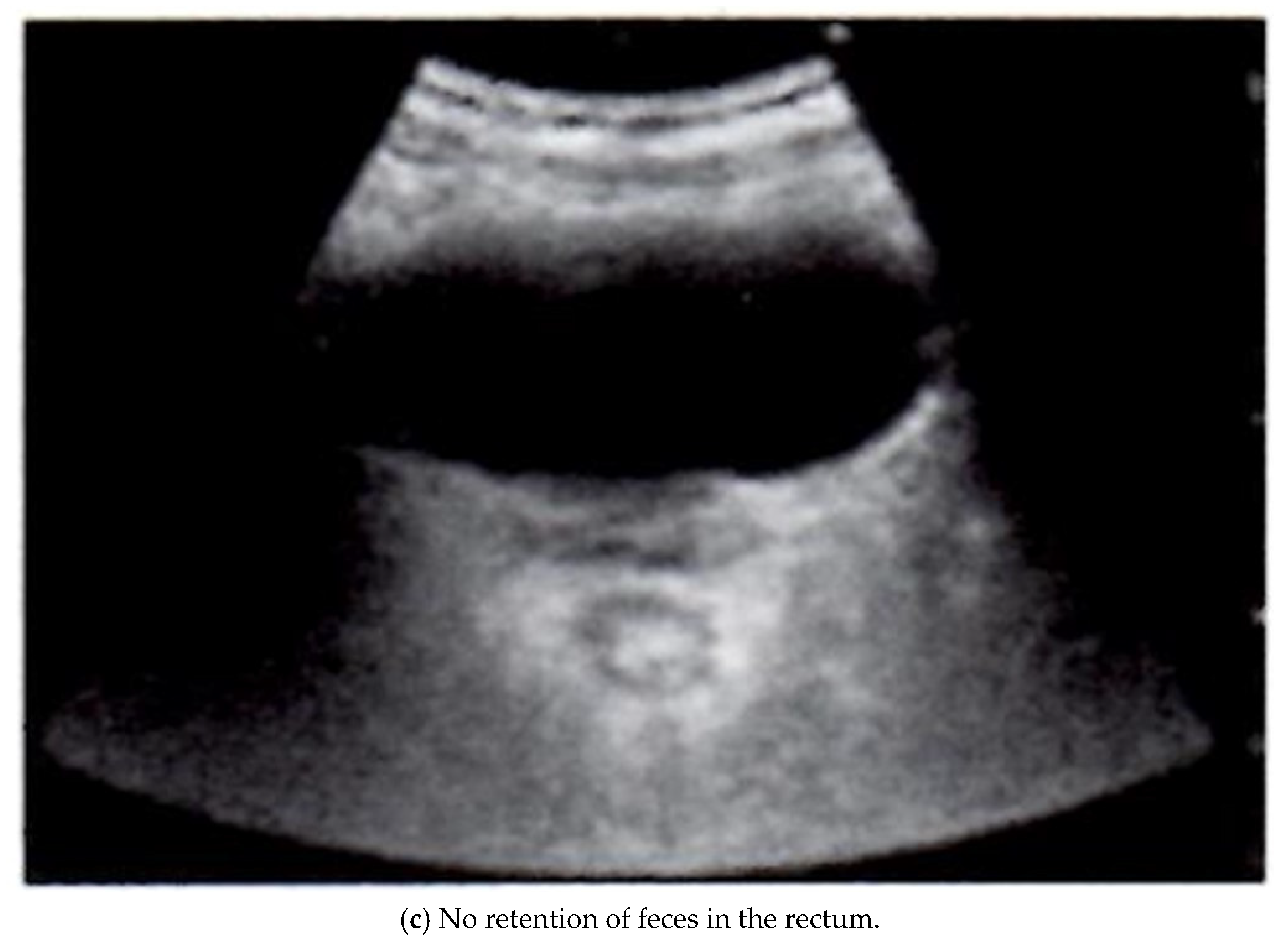 Gastrointestdisord 07 00012 g001b