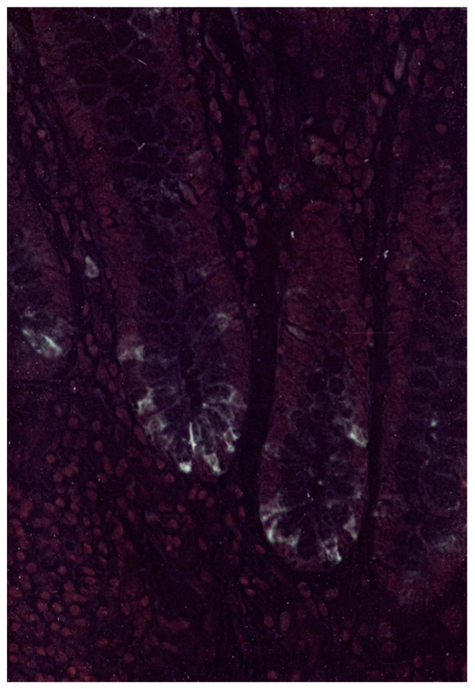 Gastrointestdisord 07 00022 g004