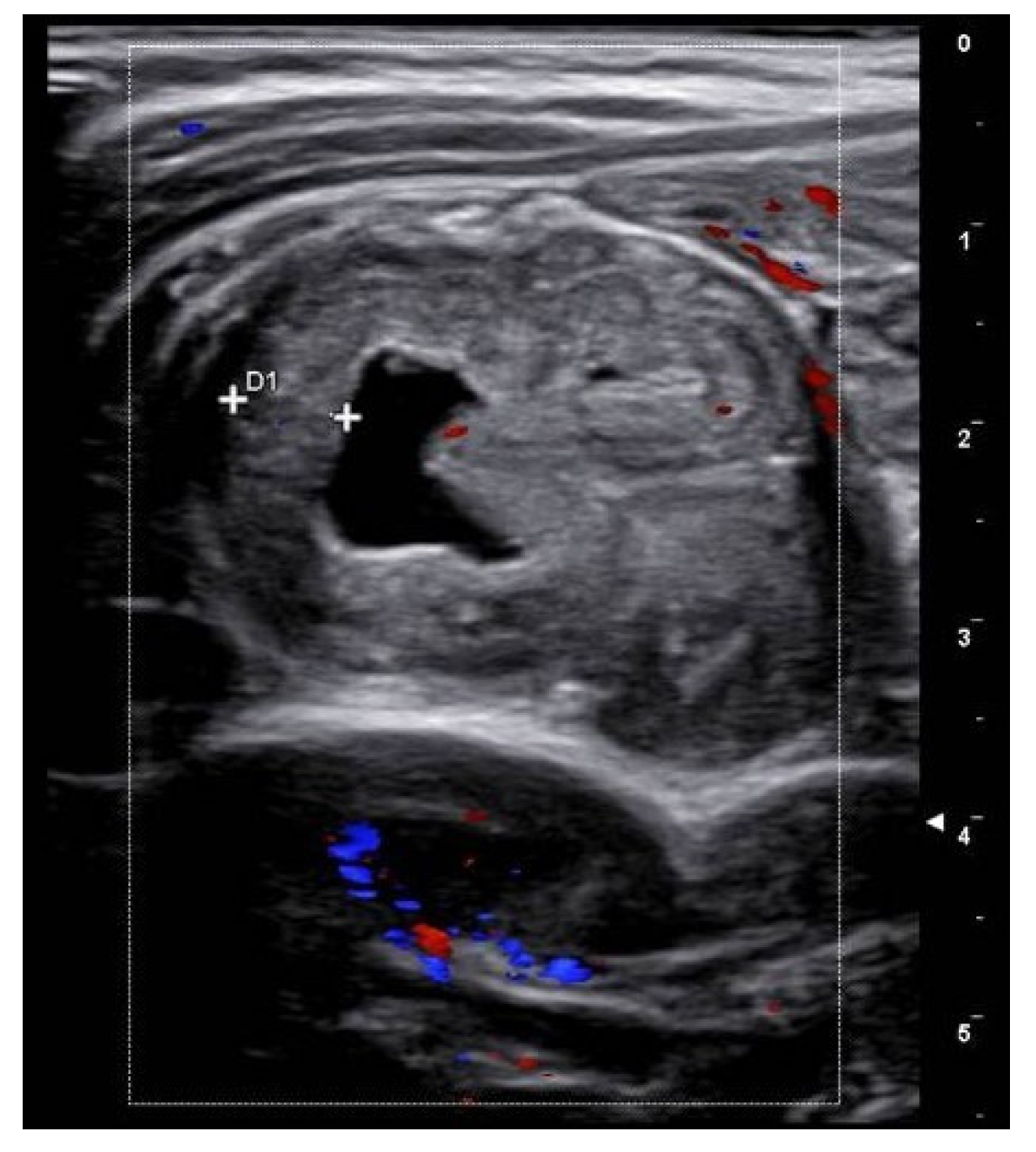 Gastrointestdisord 07 00024 g001