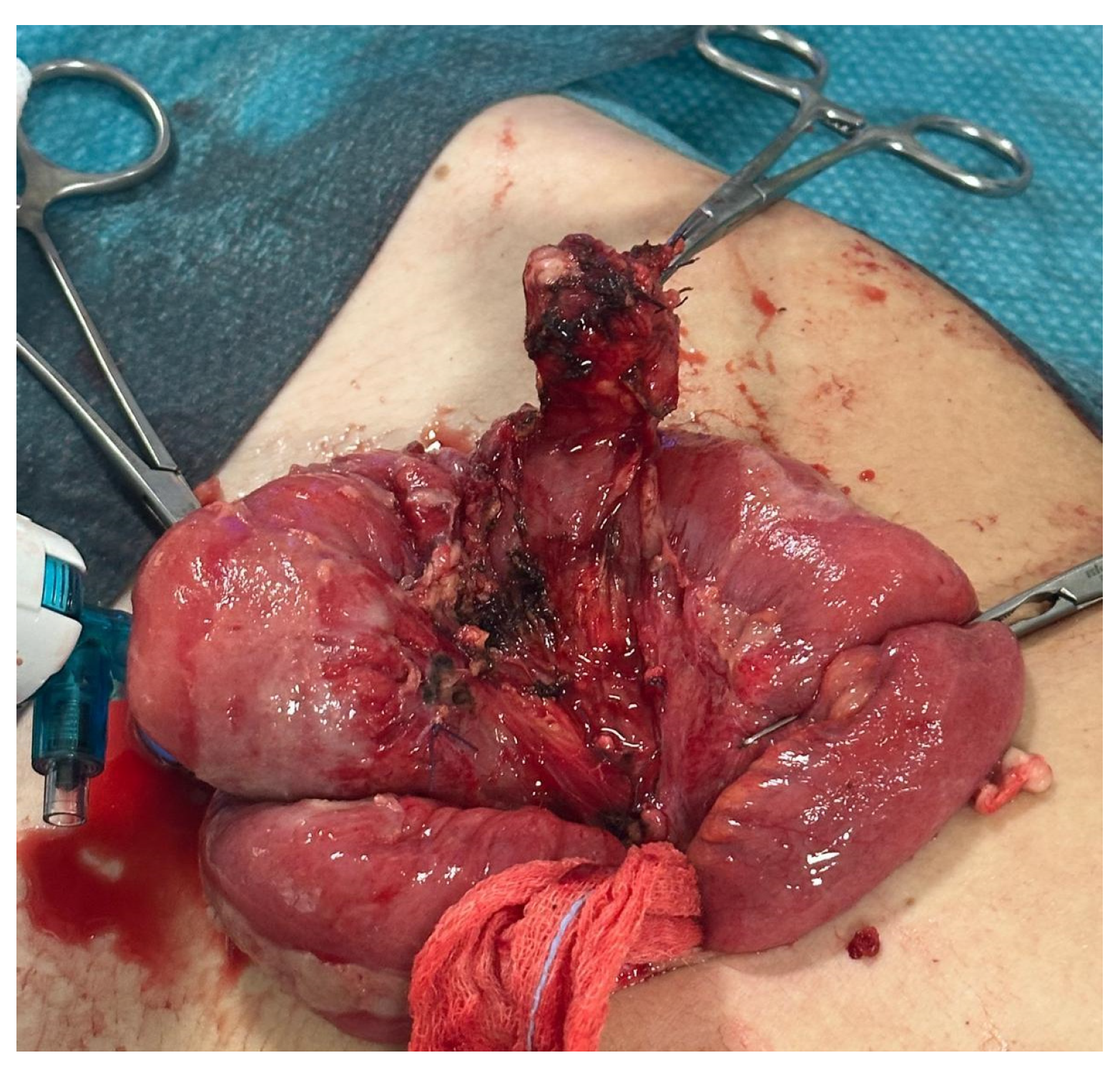 Gastrointestdisord 07 00024 g004