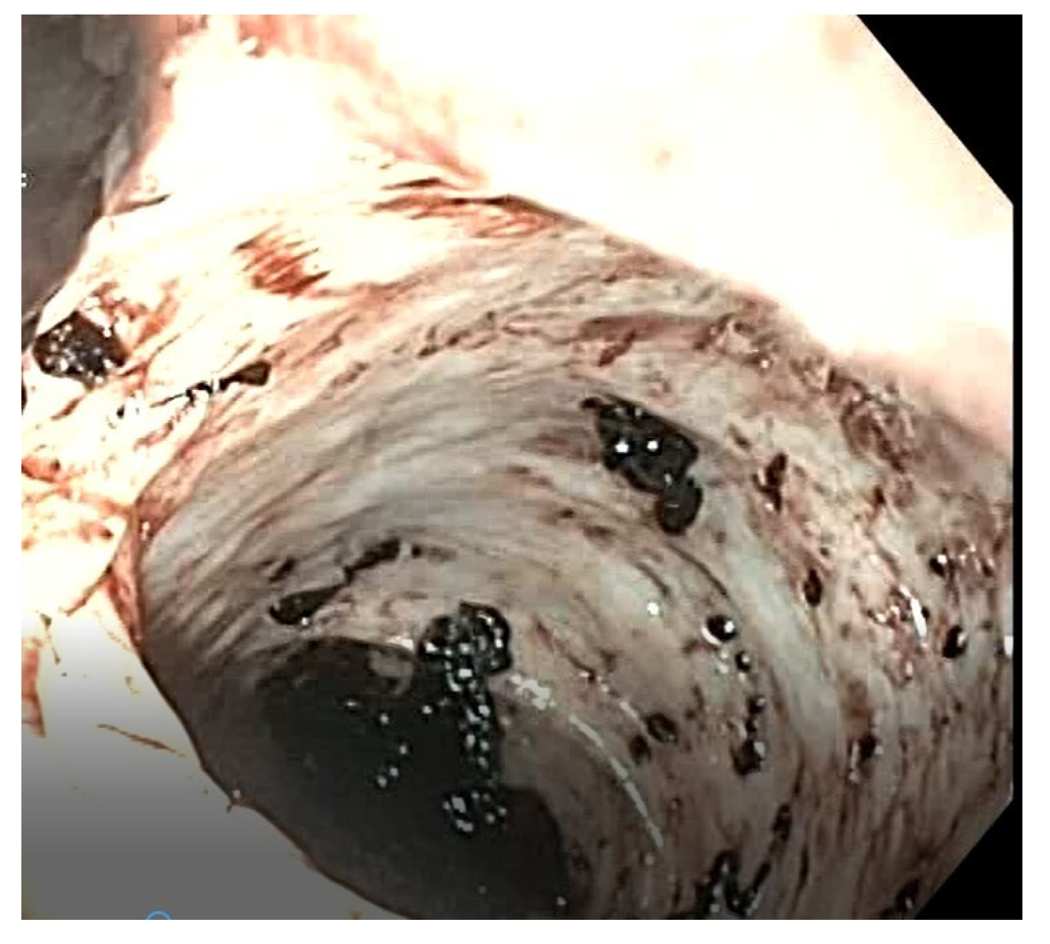 Gastrointestdisord 07 00024 g005