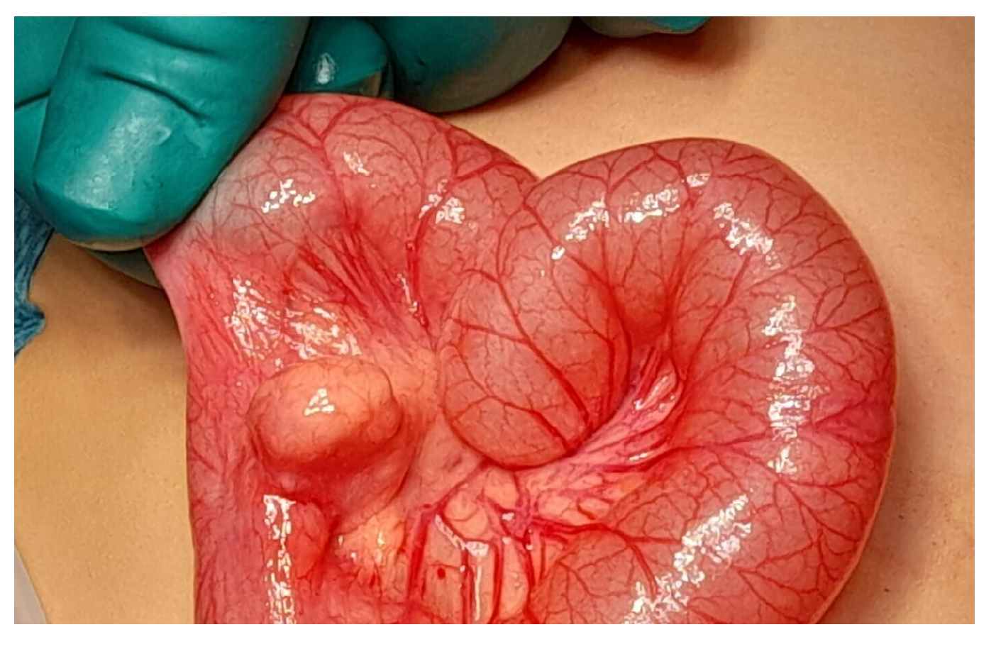 Gastrointestdisord 07 00024 g006