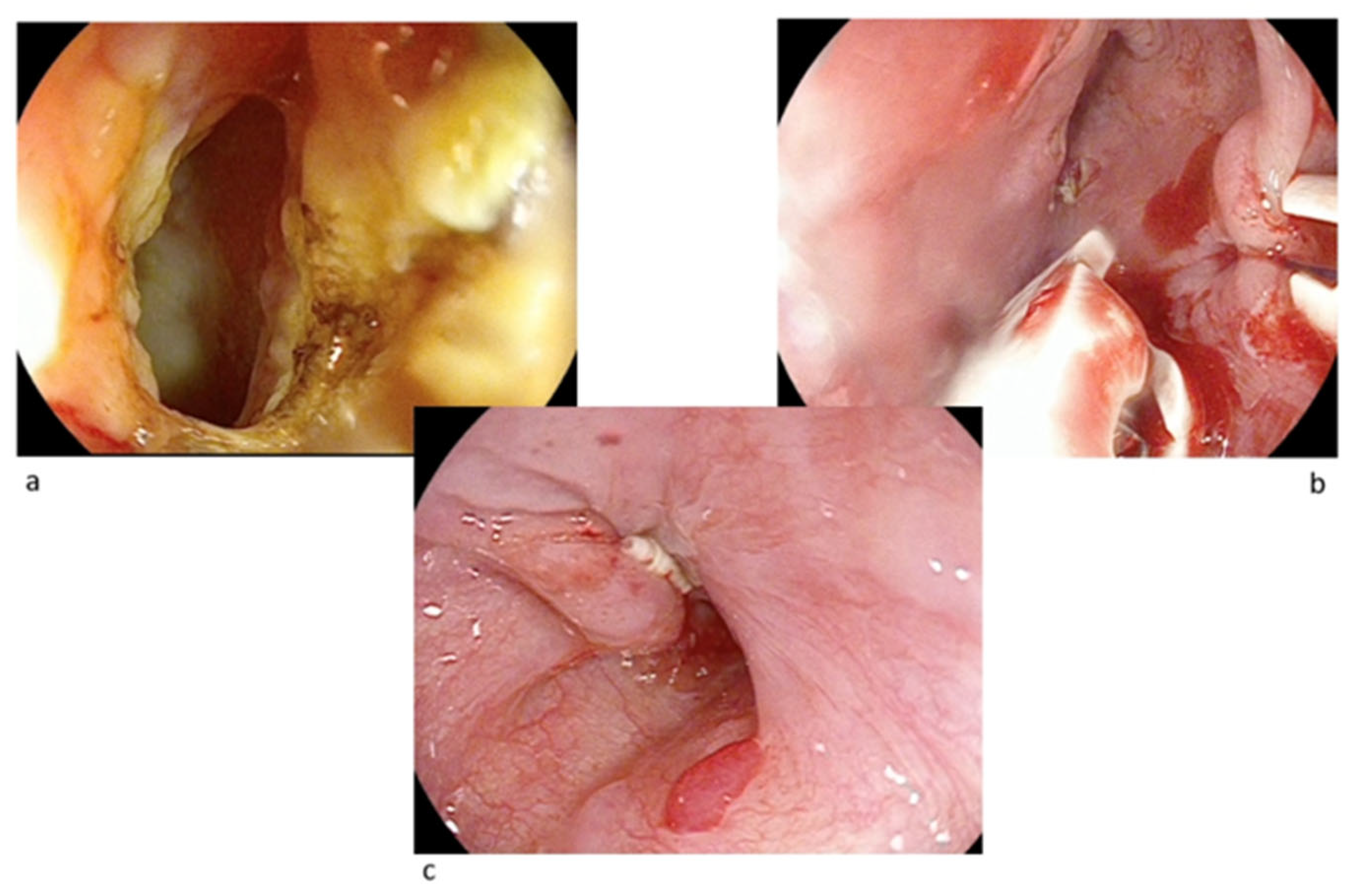 Gastrointestdisord 07 00029 g002