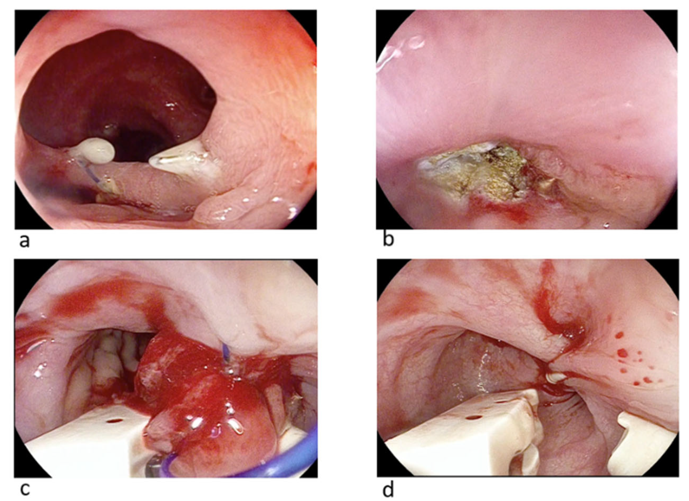 Gastrointestdisord 07 00029 g004