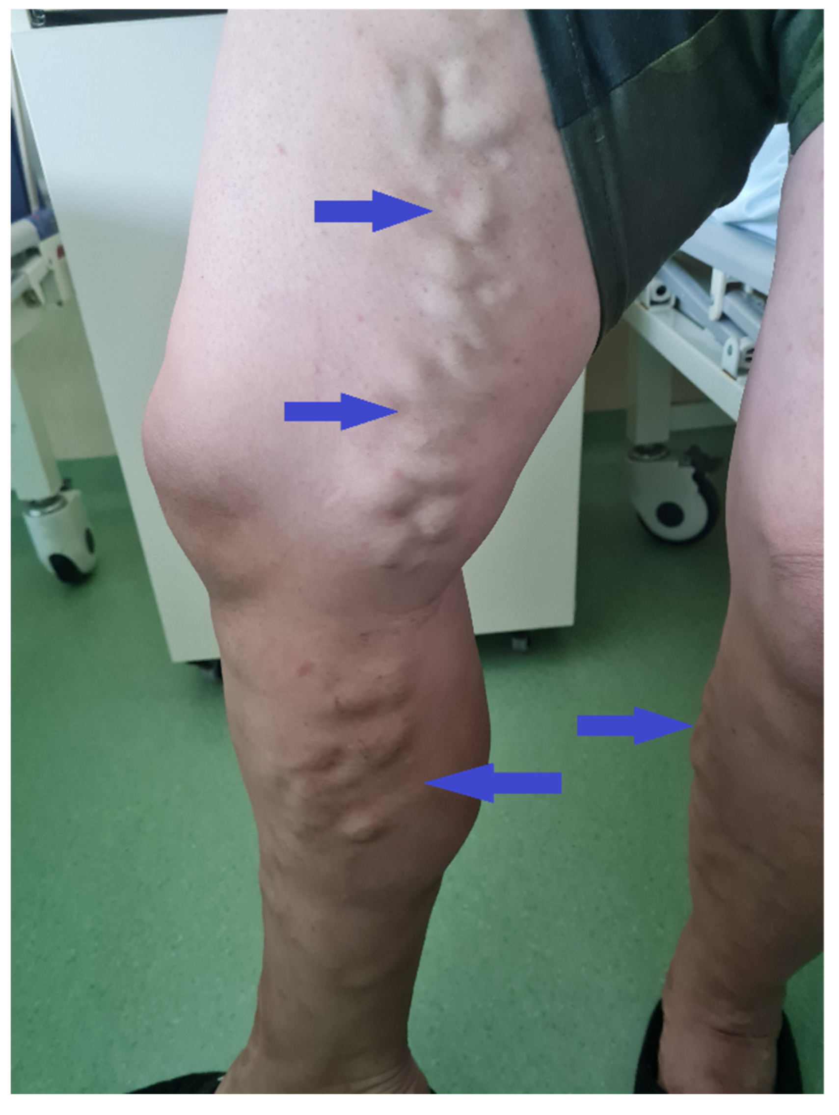 Gastrointestdisord 07 00070 g003