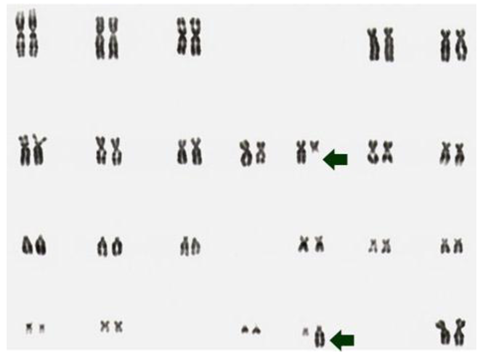 Genes 02 00397f1 1024