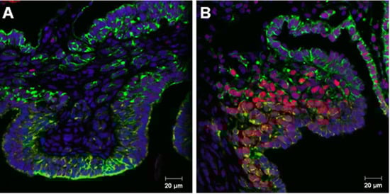 Genes 04 00293 g001 550