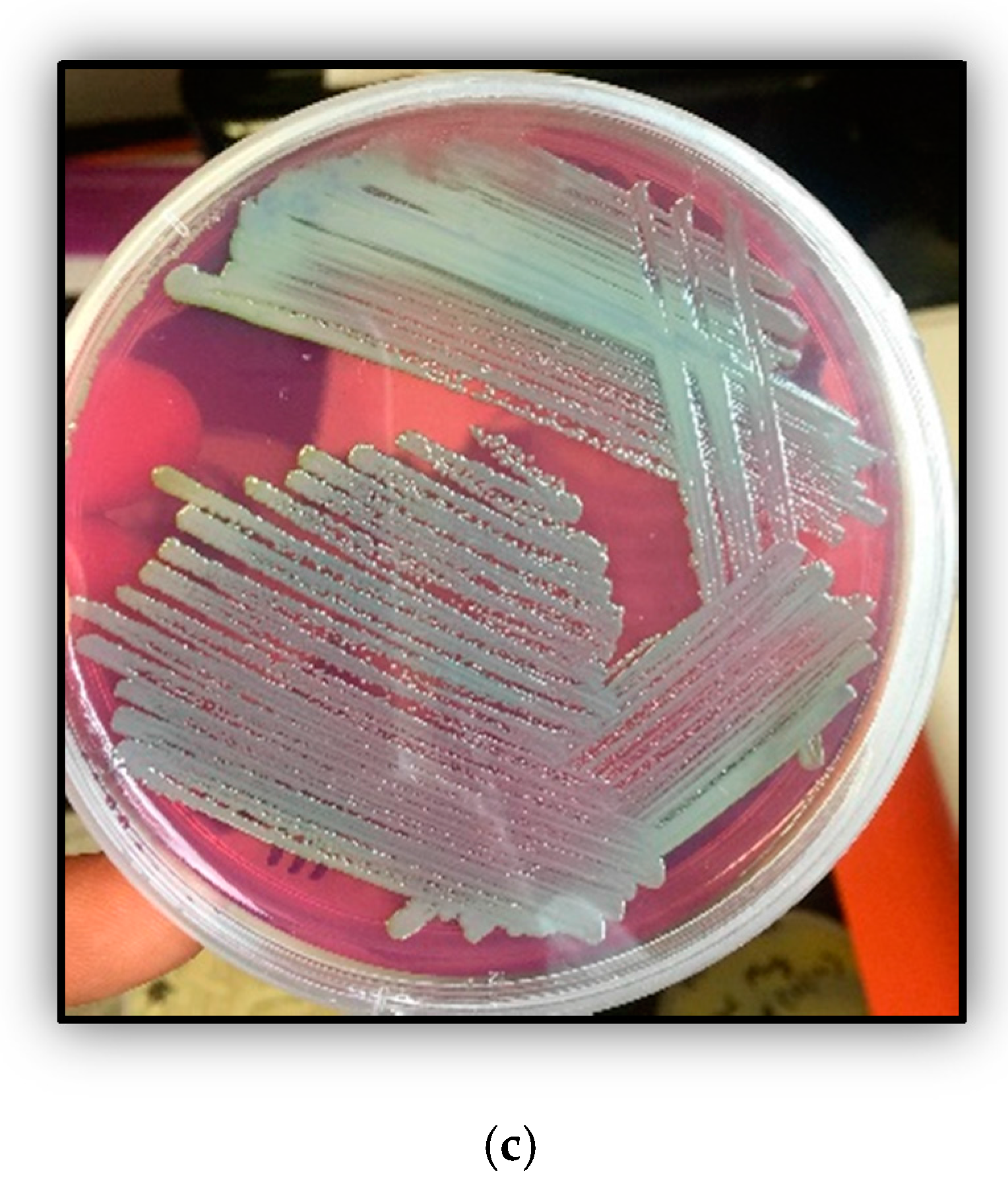 Genes 09 00031 g001b Genes 09 00031 g001b