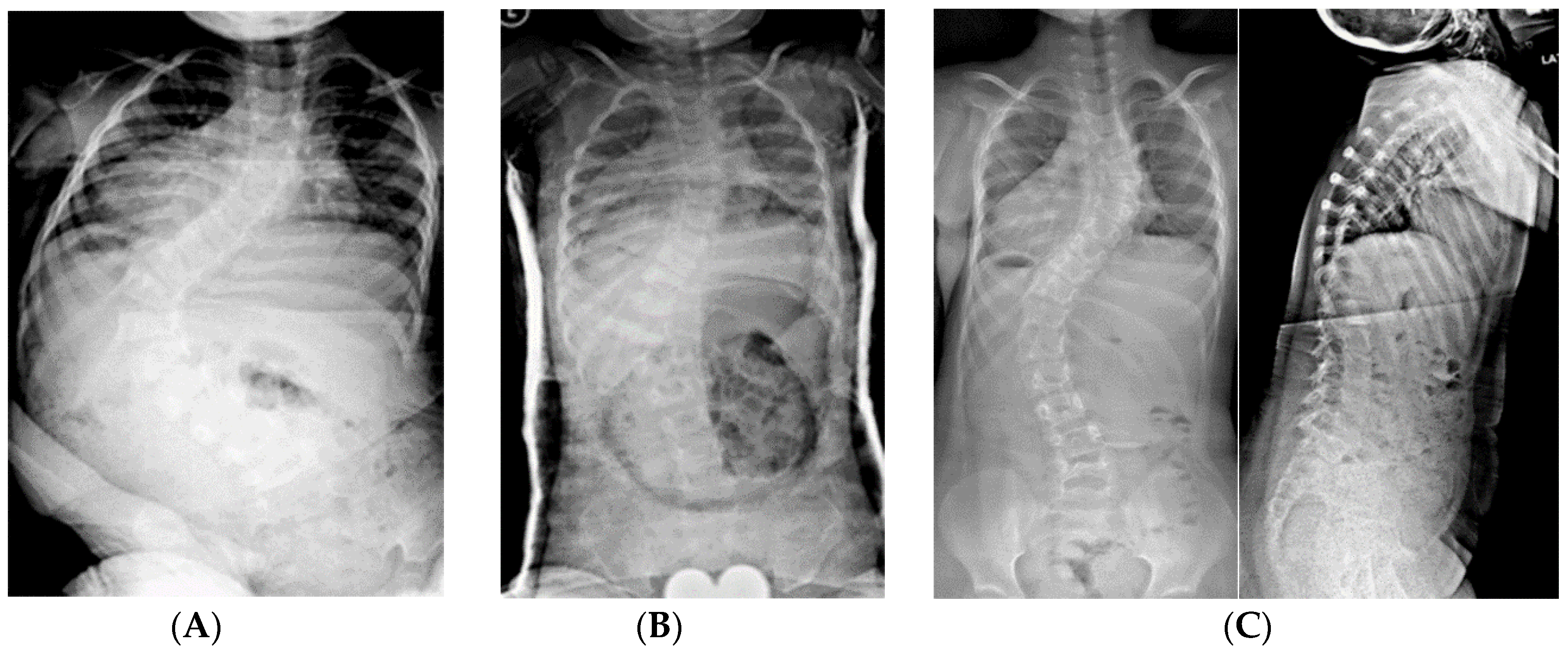 Genes 11 00260 g004a