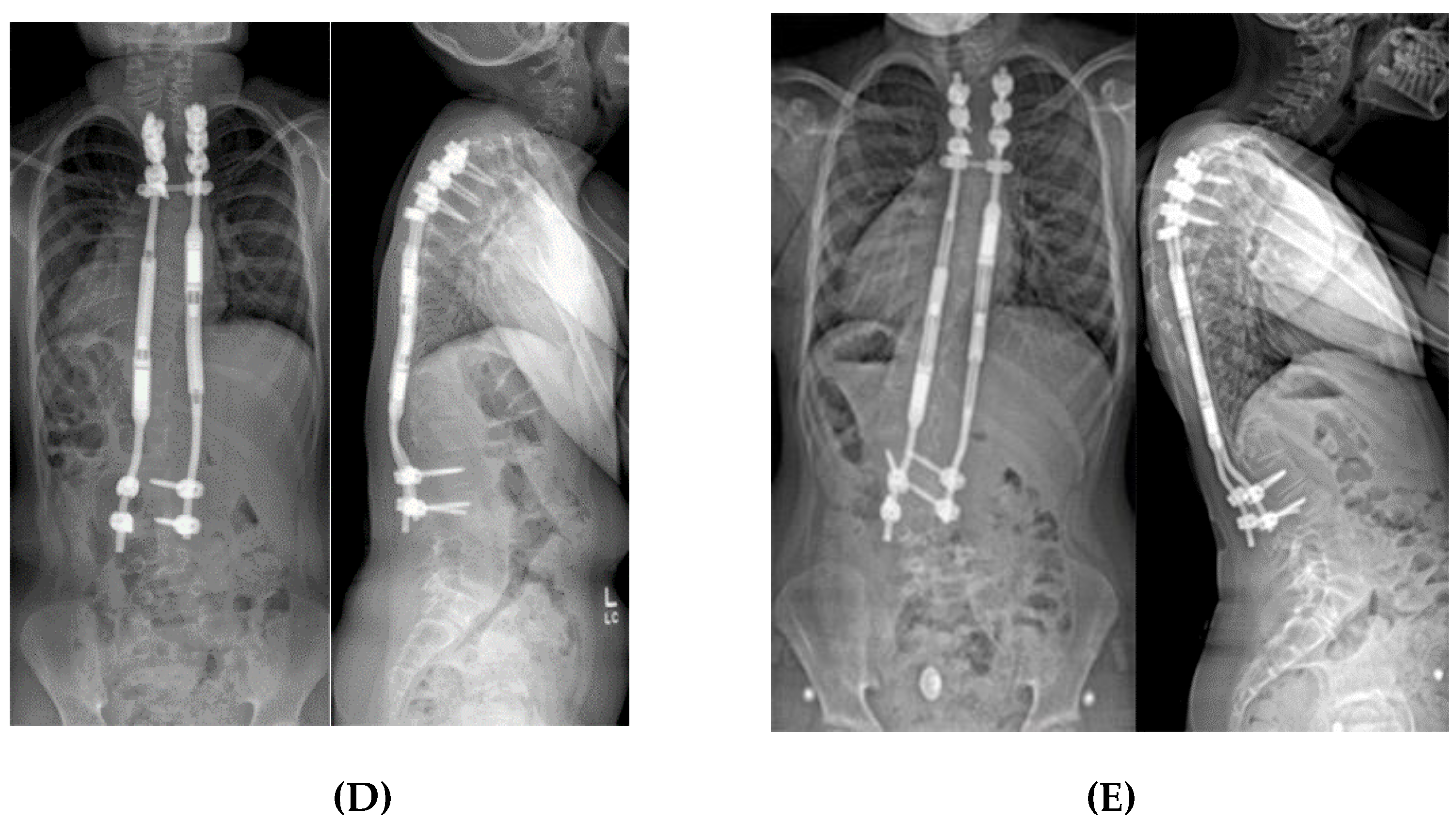 Genes 11 00260 g004b