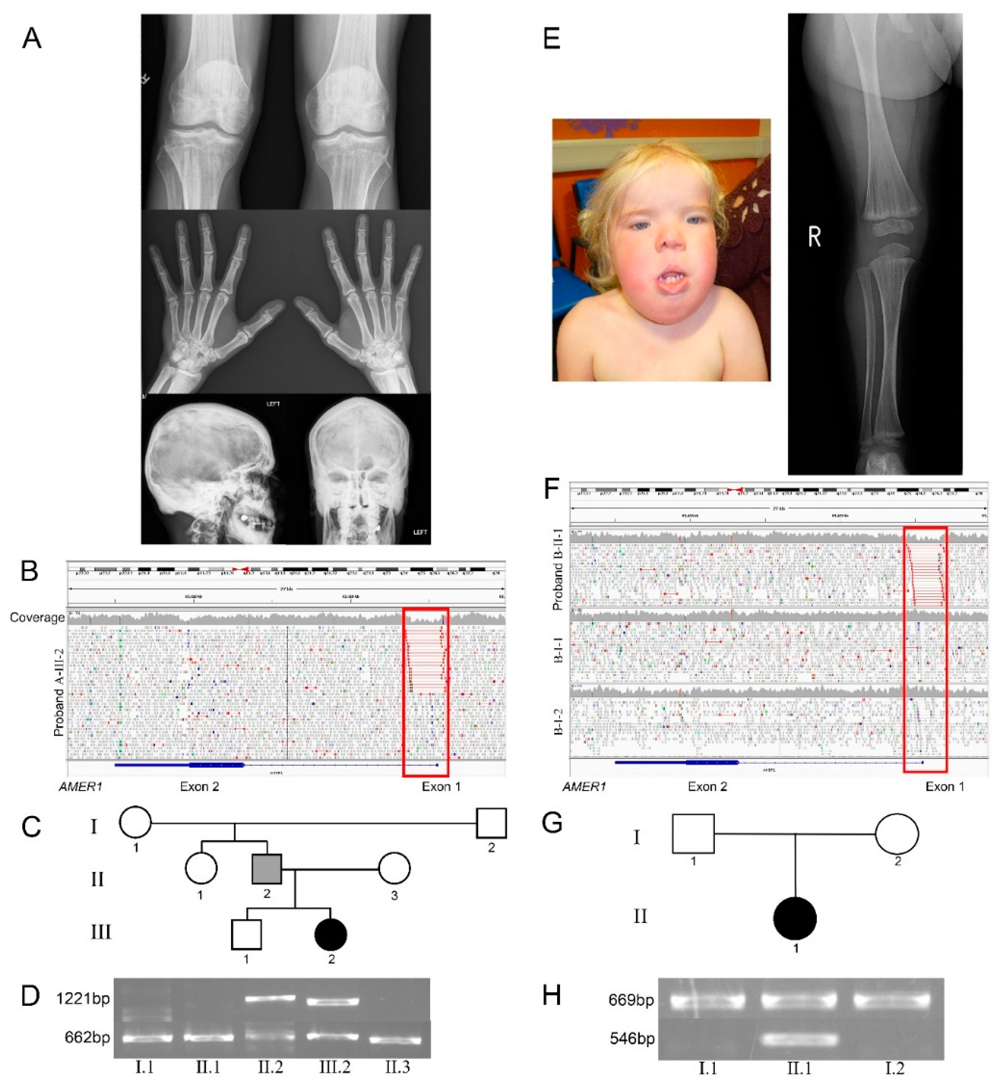 Genes 11 01439 g001