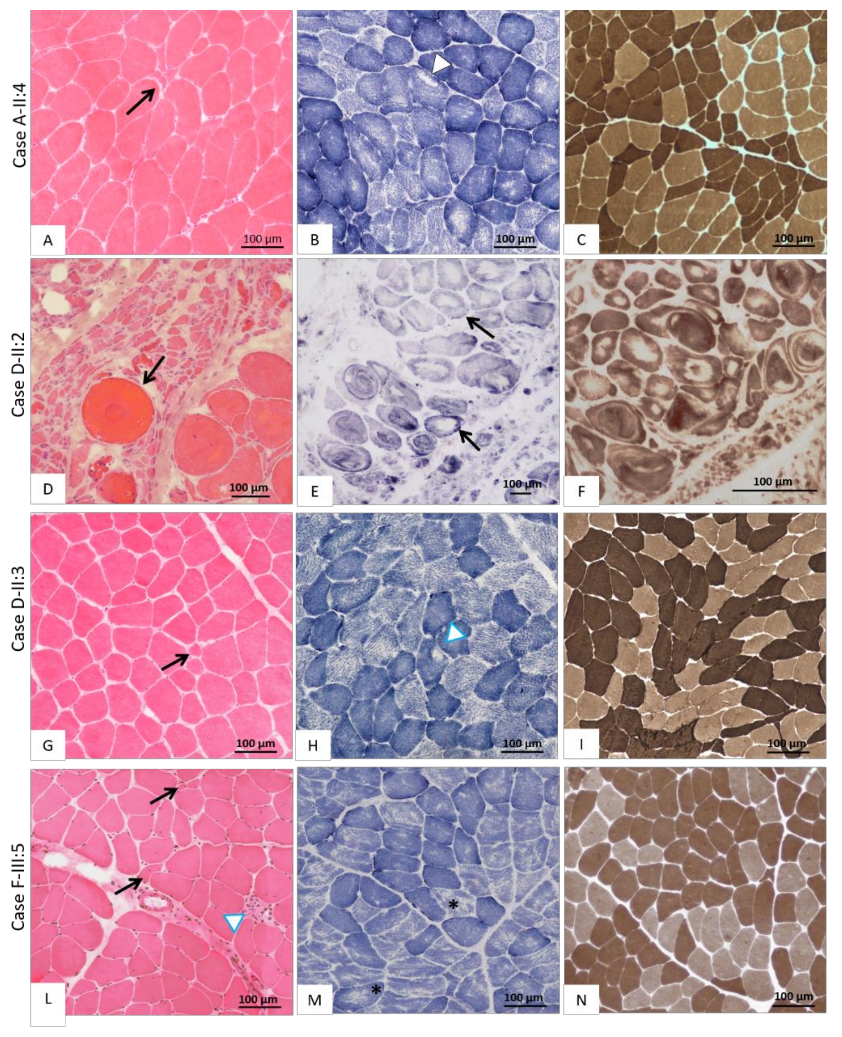 Genes 12 00344 g003 Genes 12 00344 g003