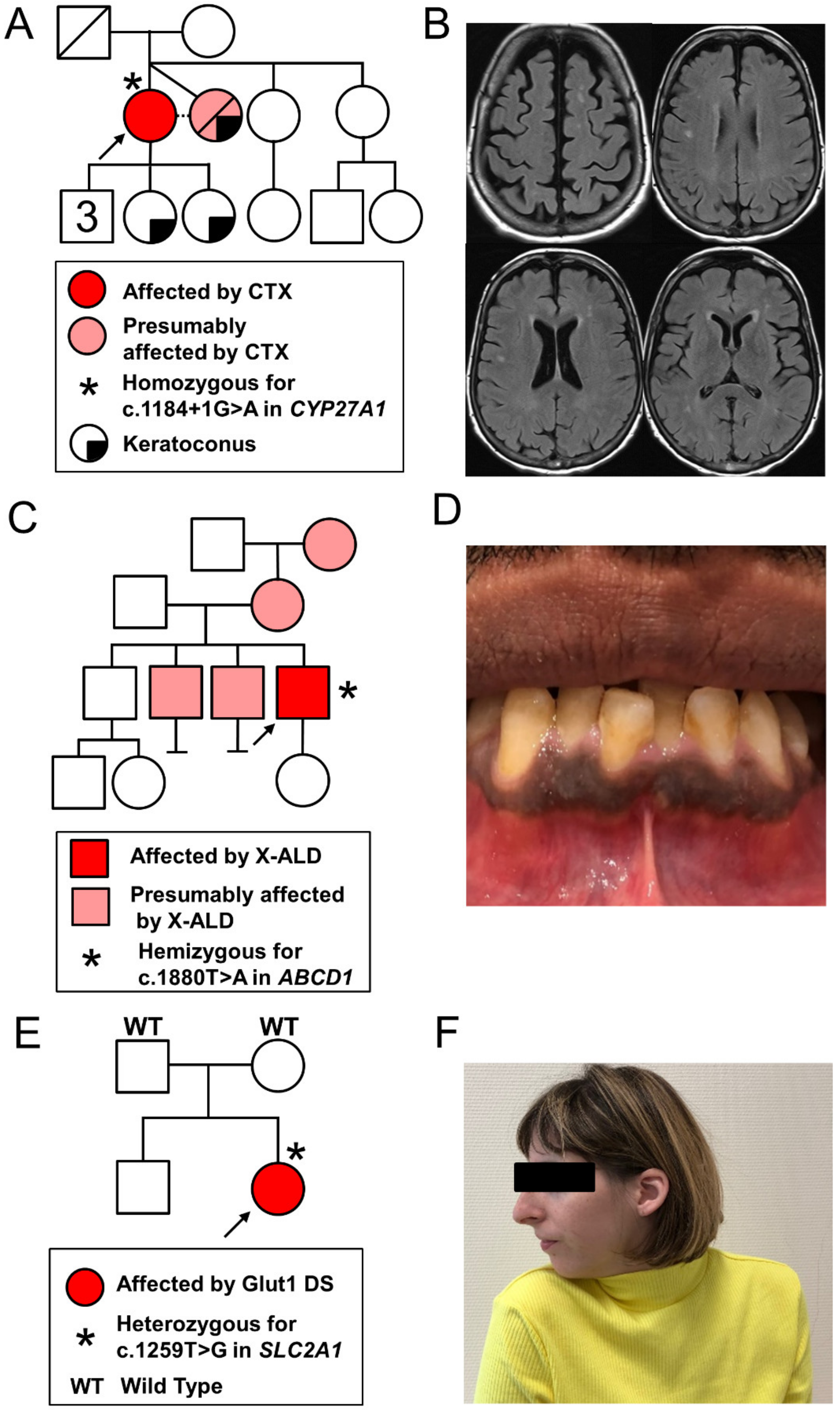 Genes 12 00695 g001
