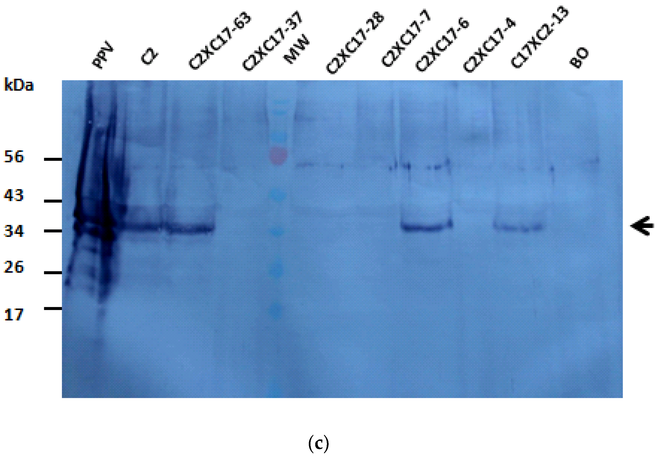 Genes 12 00816 g003b Genes 12 00816 g003b