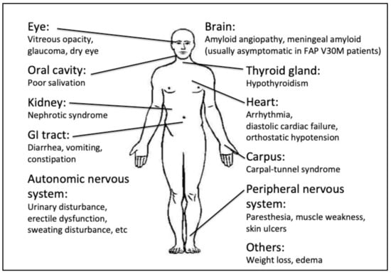 Genes 12 00955 g001 550