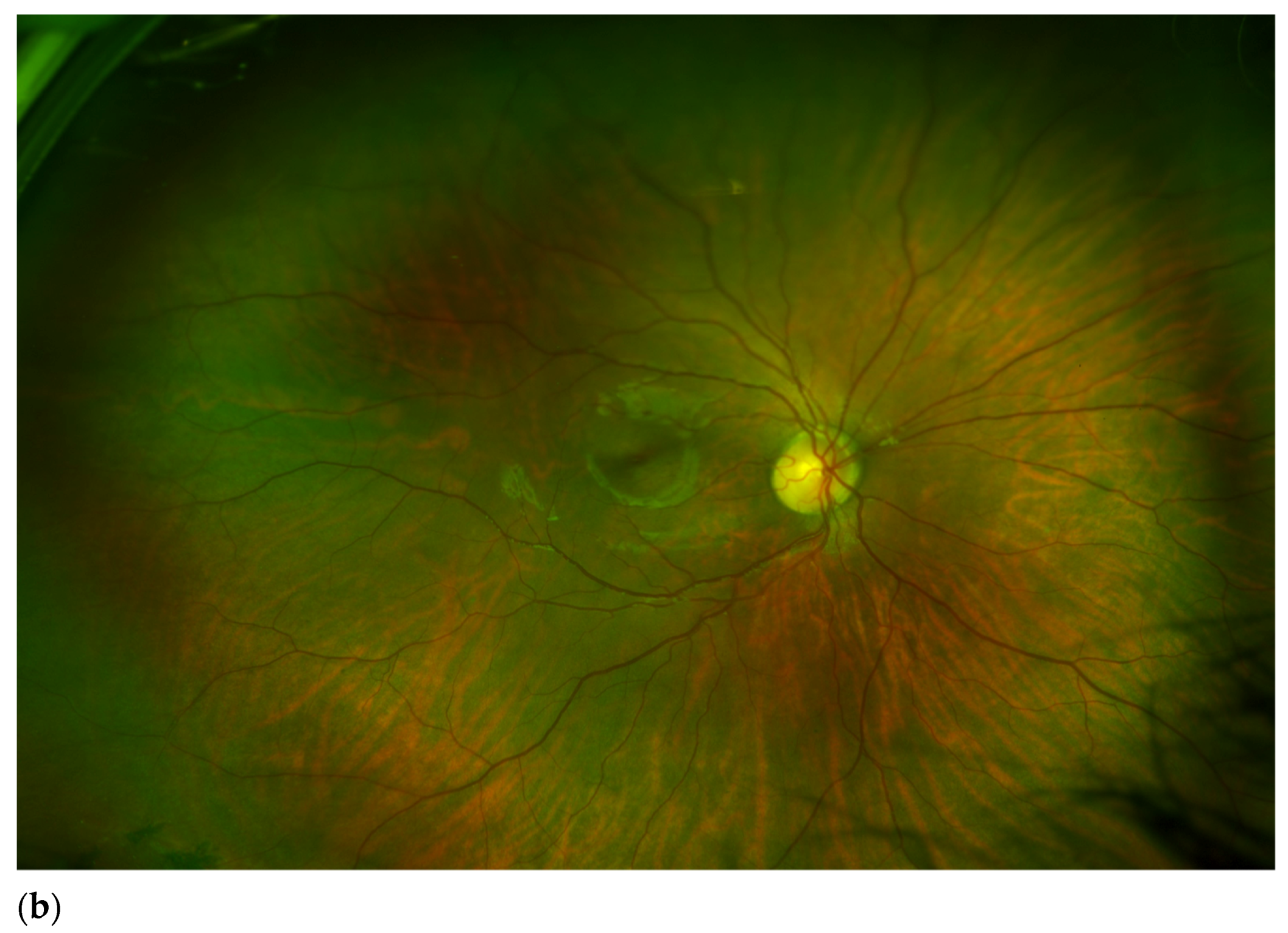 Genes 12 01069 g001b