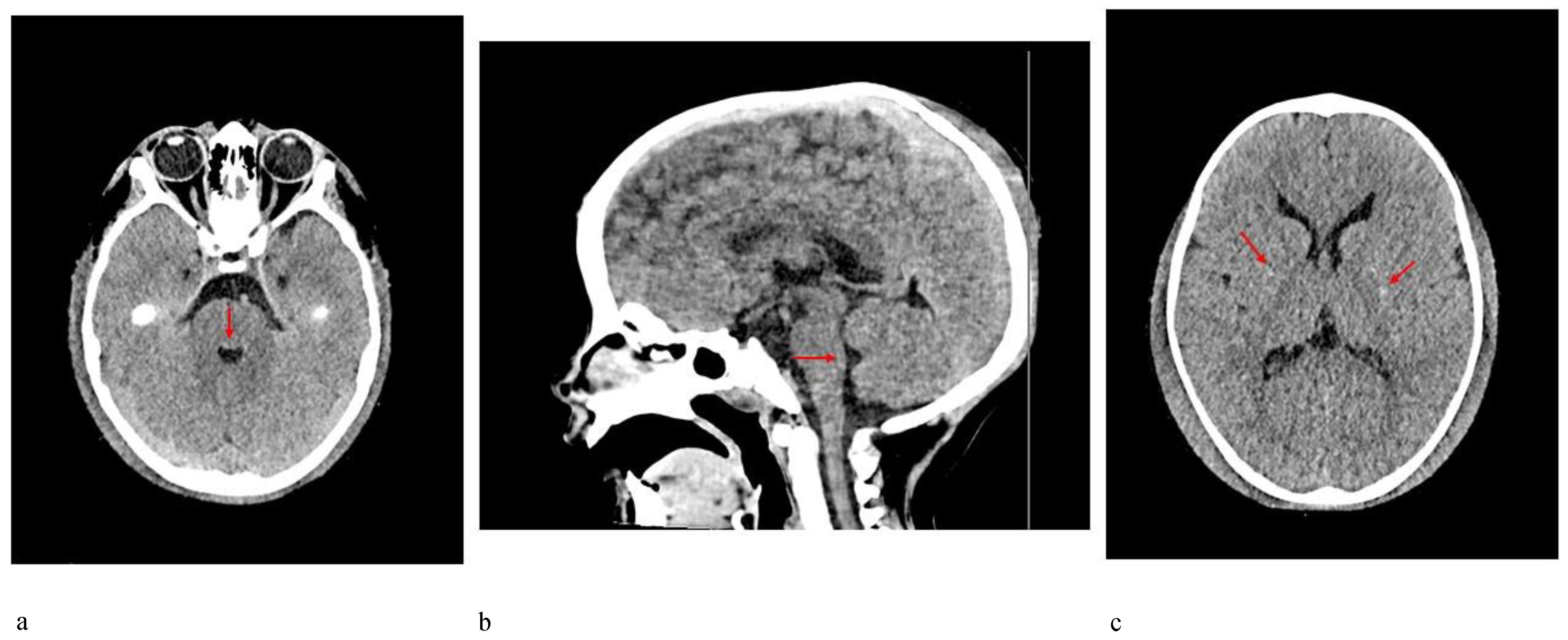 Genes 12 01187 g004