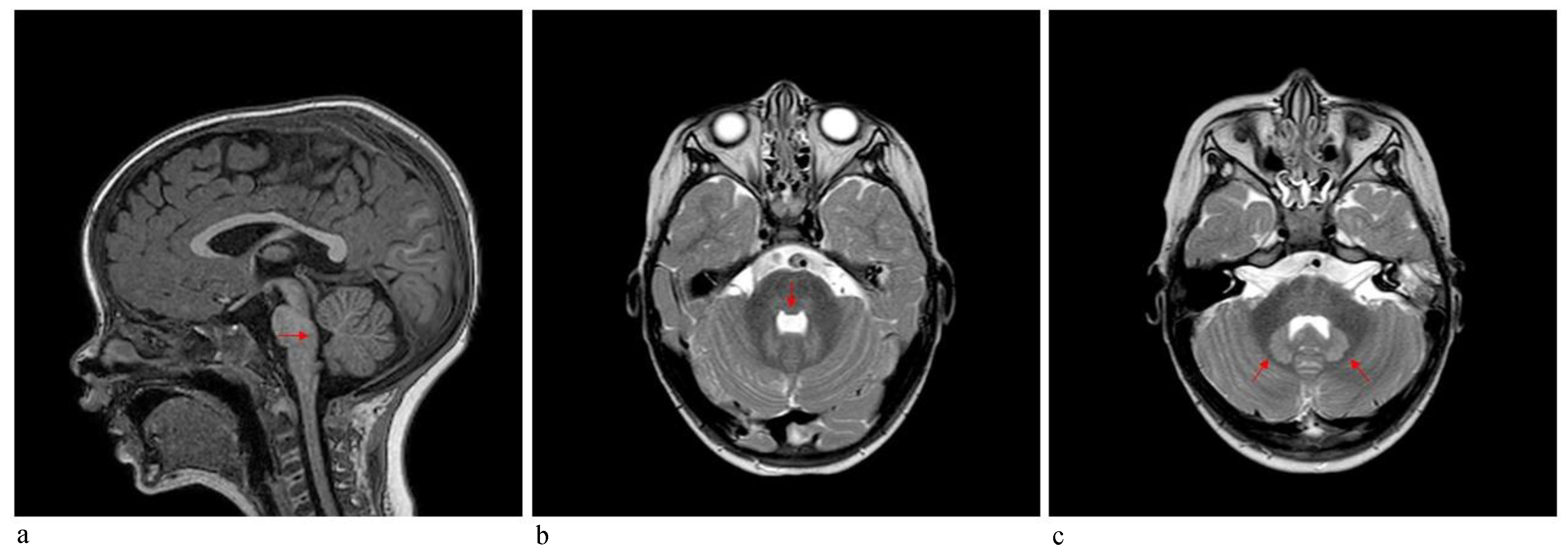 Genes 12 01187 g005