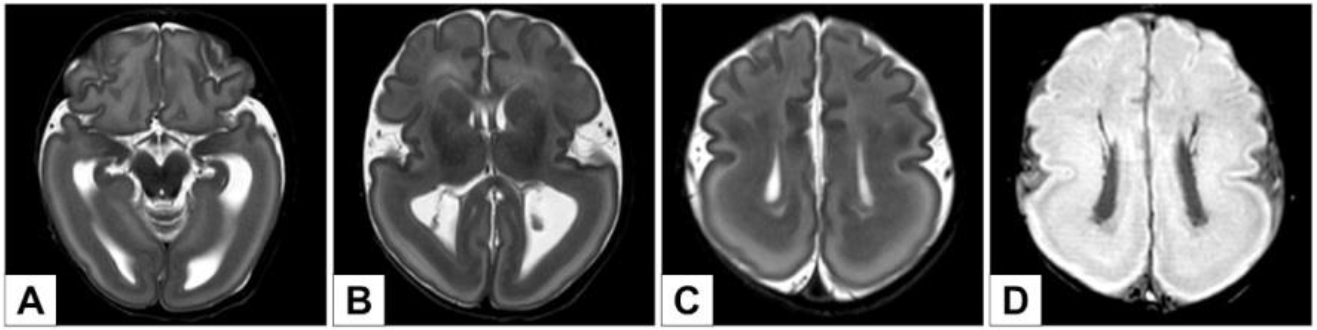 Genes 12 01208 g002