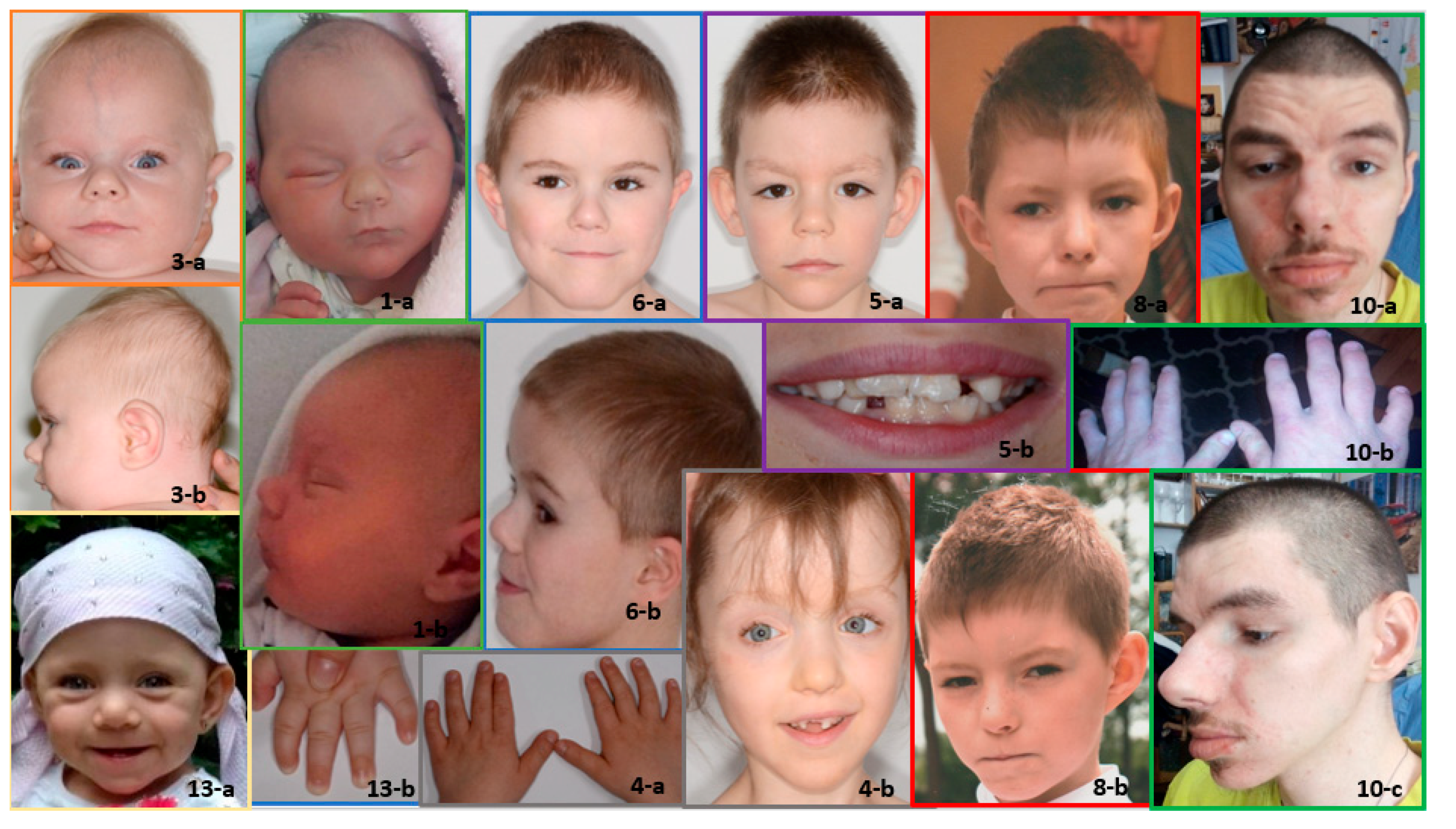 Genes 12 01257 g001