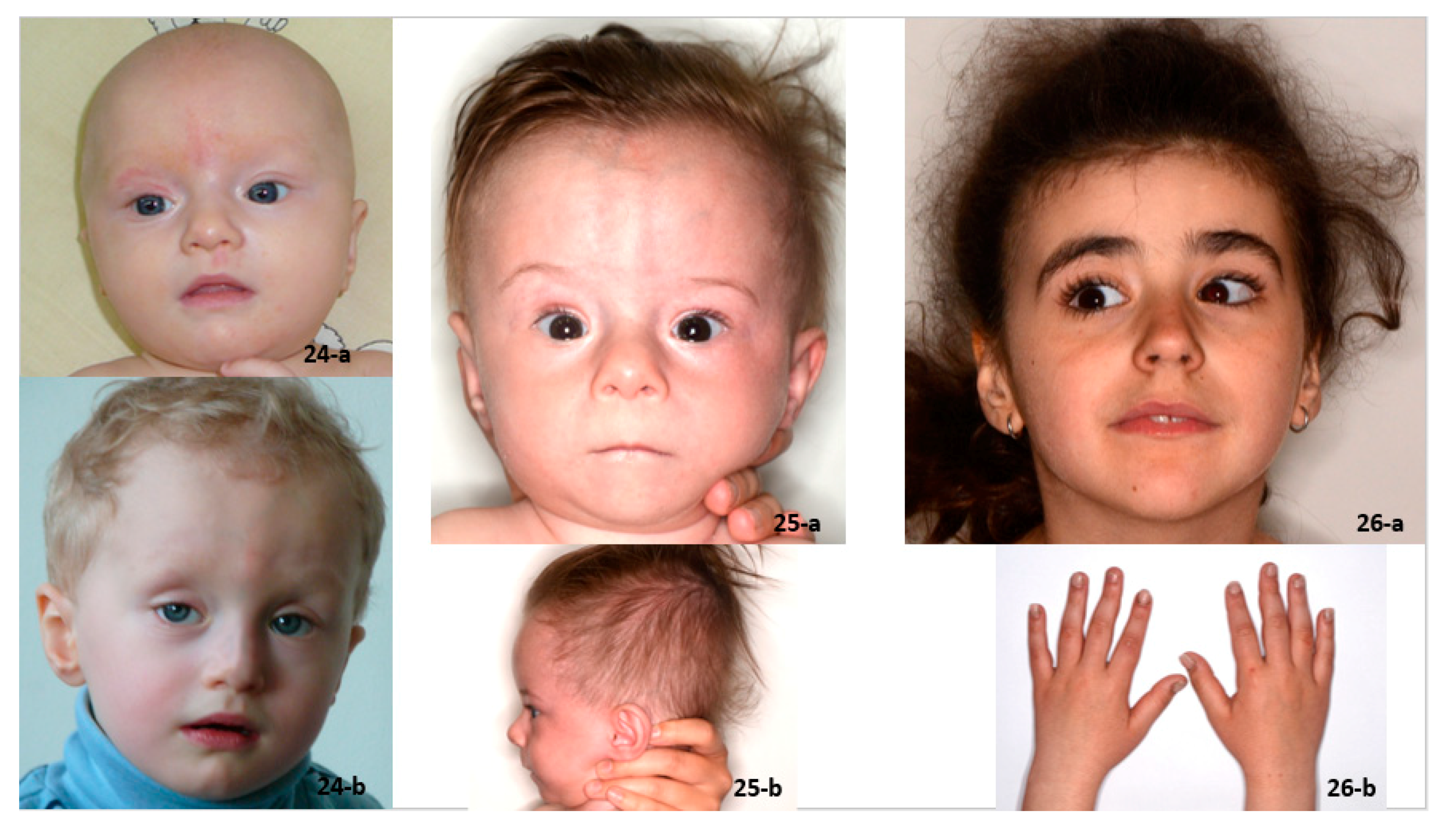 Genes 12 01257 g004