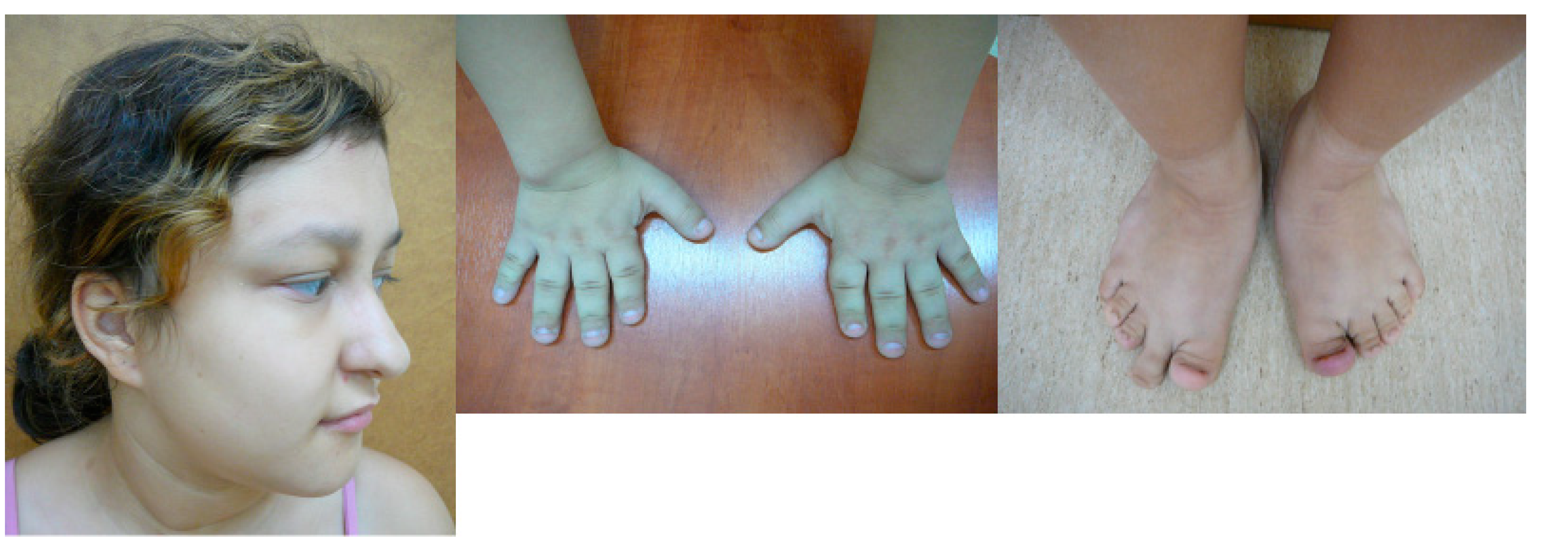 Genes 12 01257 g005