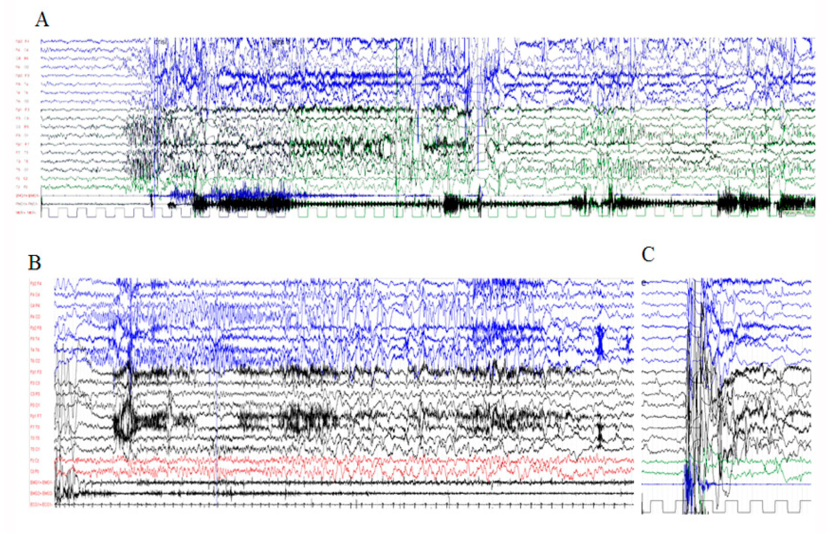 Genes 12 01316 g001