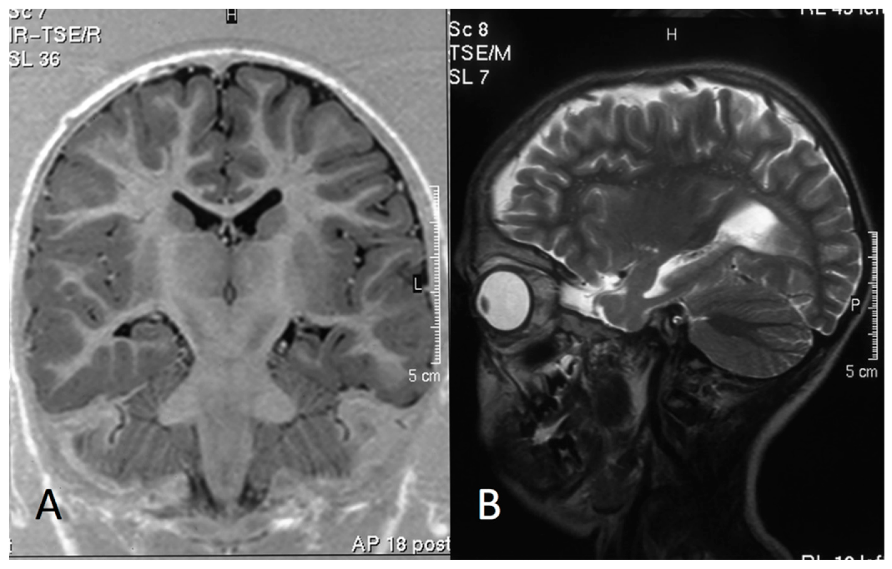 Genes 12 01316 g003