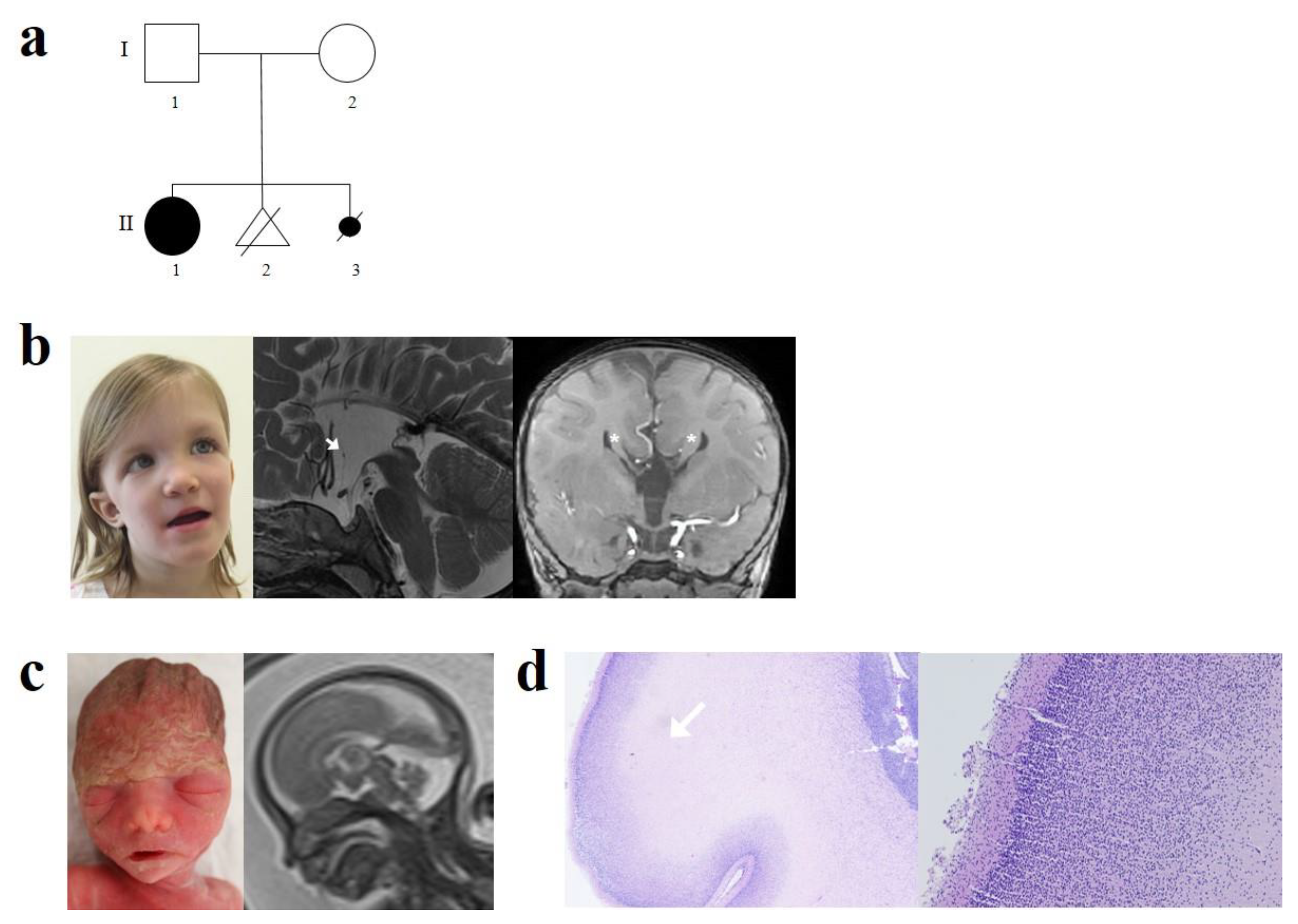 Genes 12 01397 g001