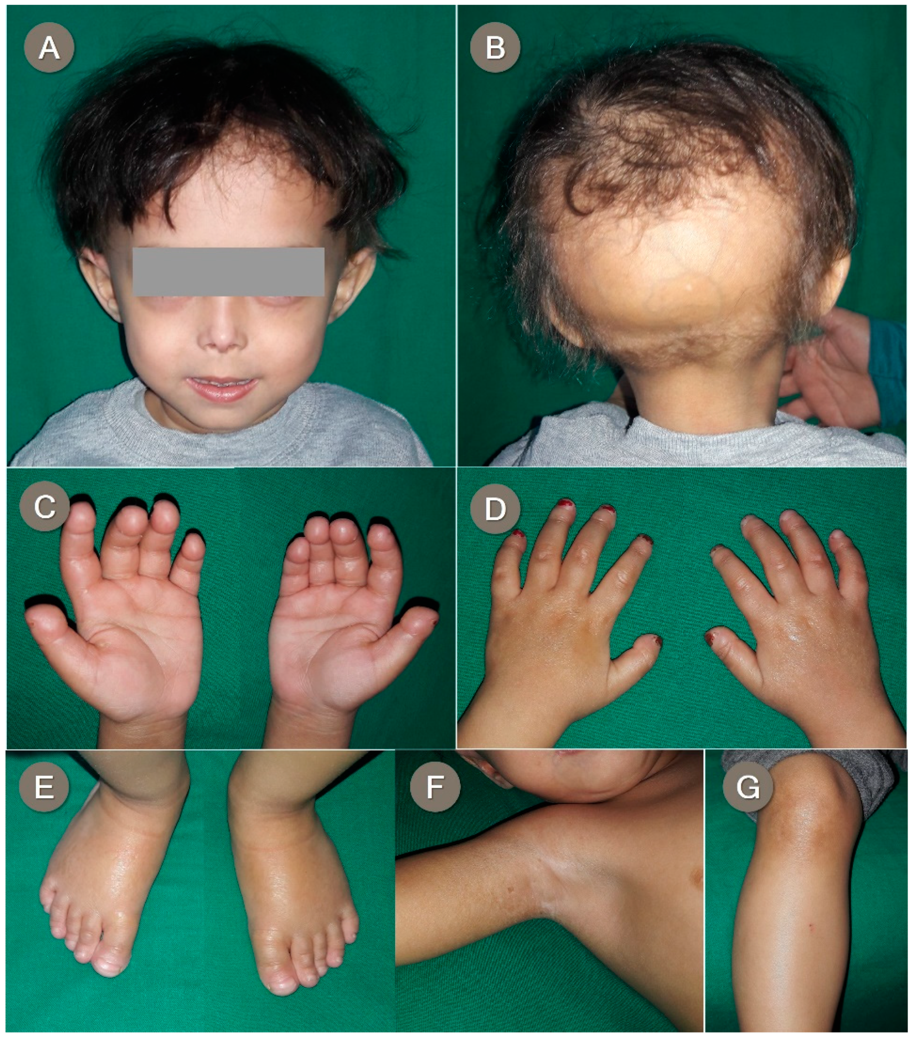Genes 12 01508 g003
