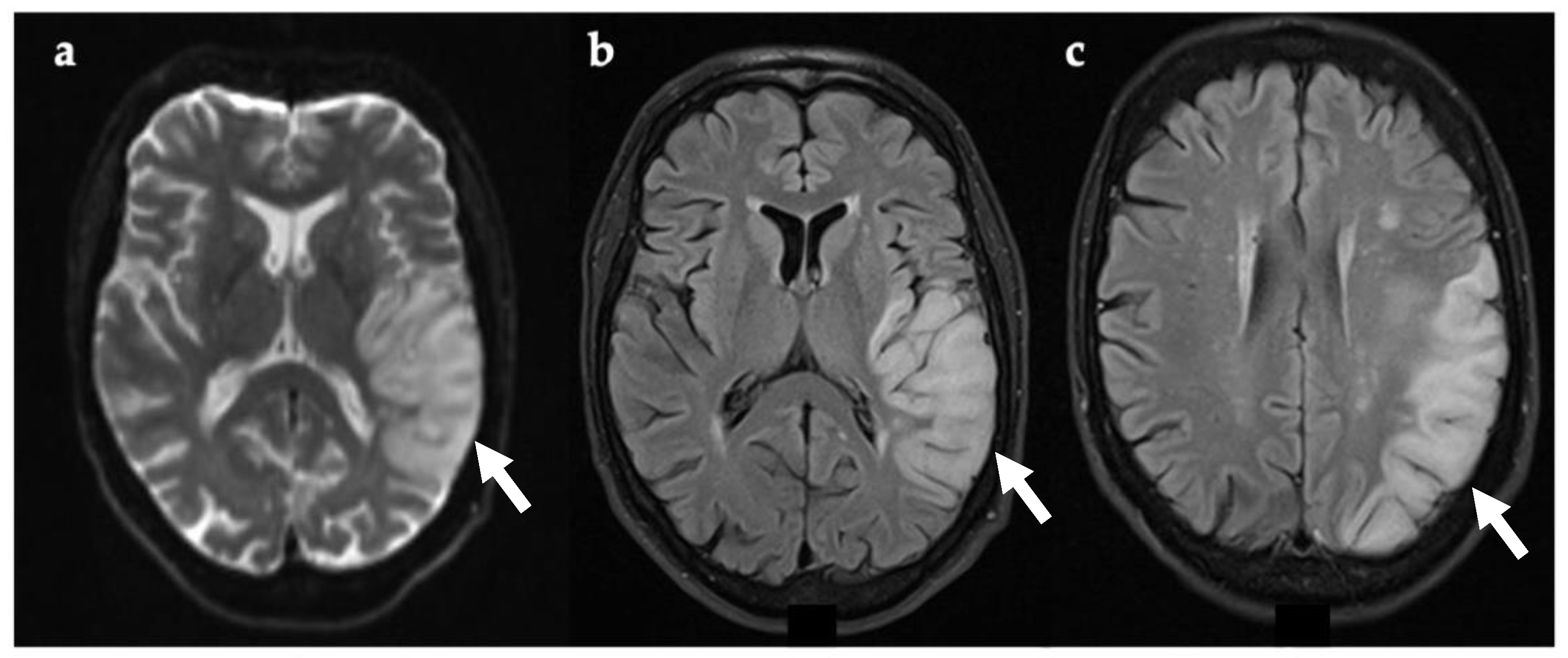 Genes 12 01643 g003 Genes 12 01643 g003