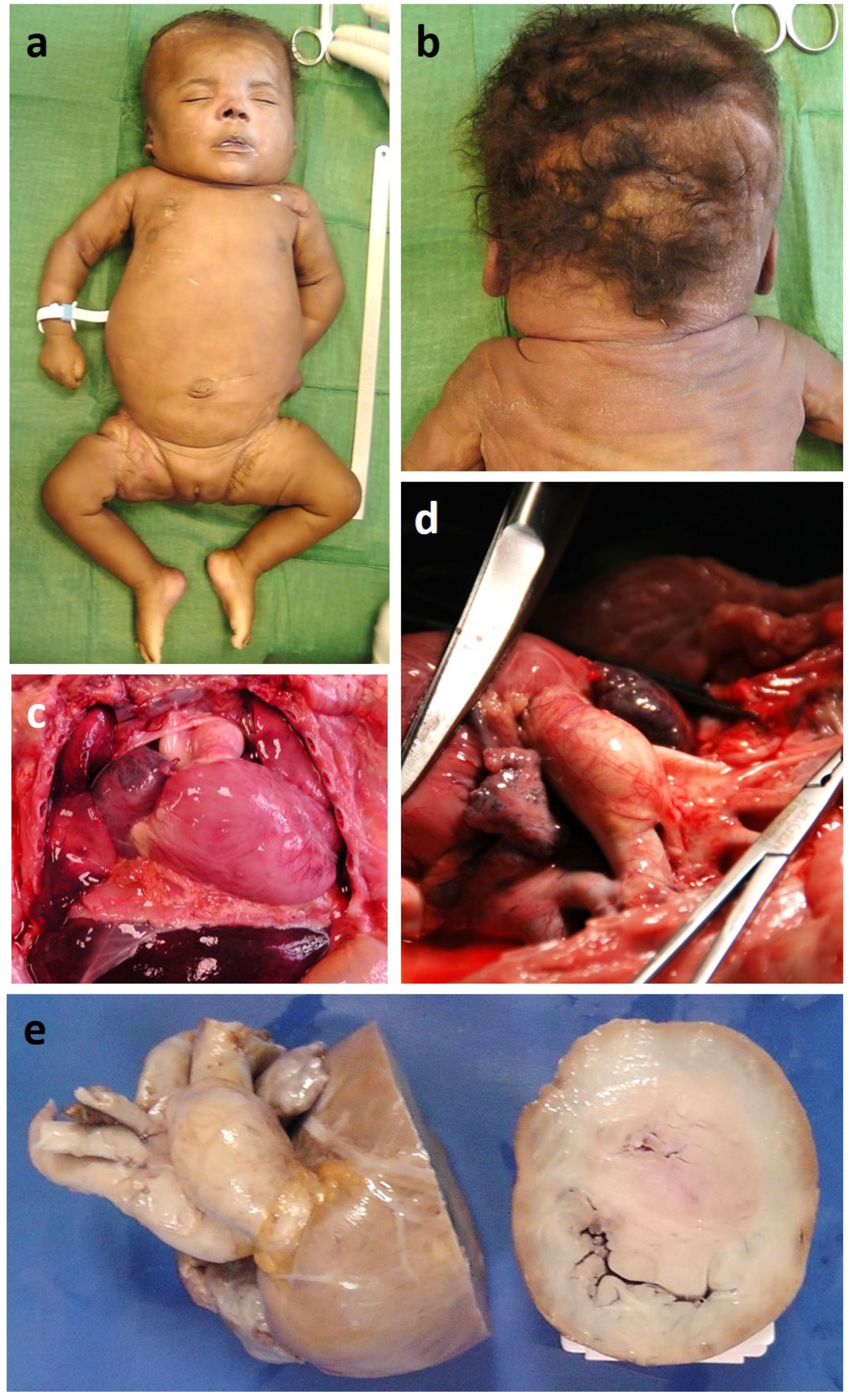 Genes 13 00006 g003 Genes 13 00006 g003