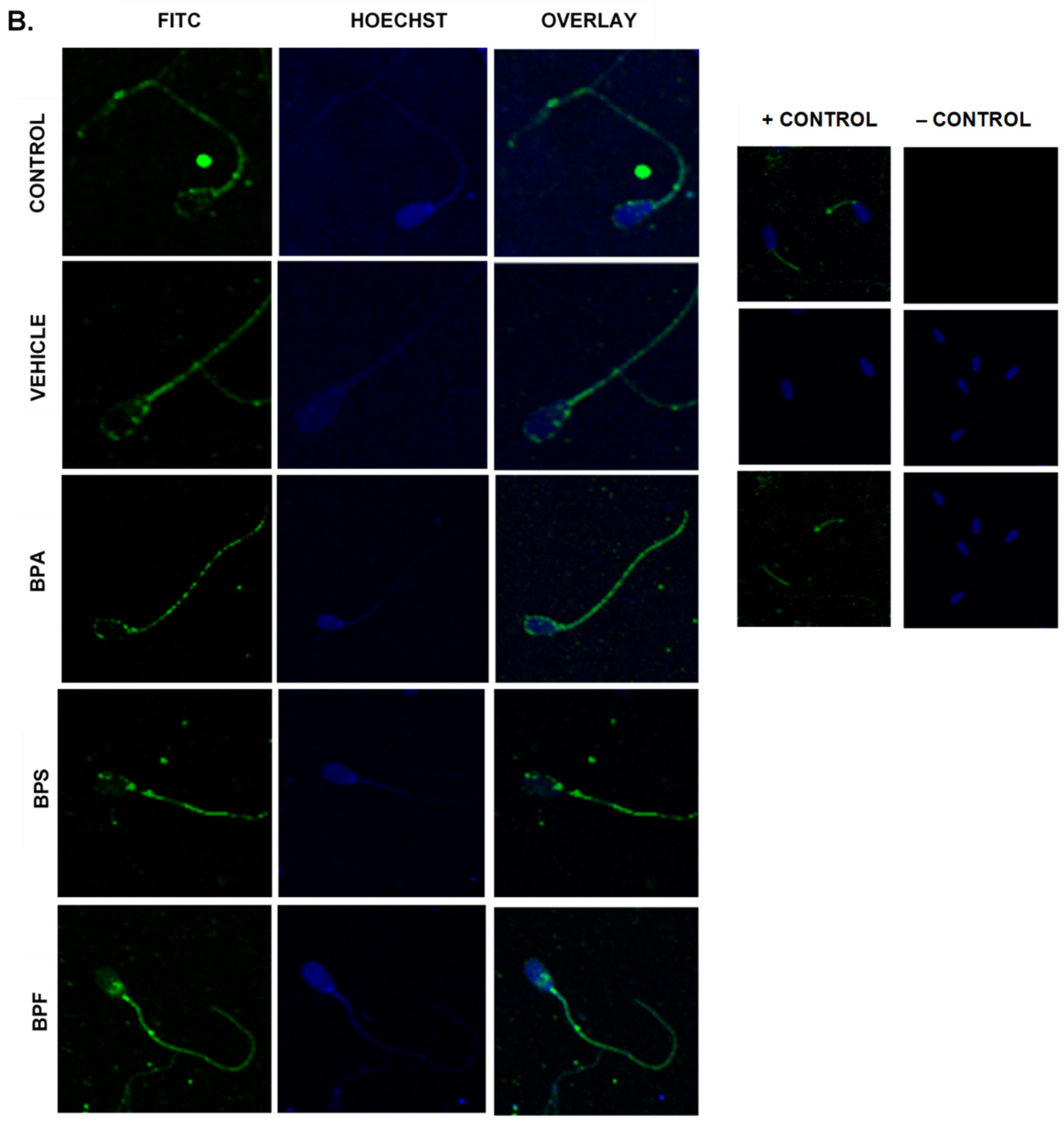 Genes 13 00142 g010b