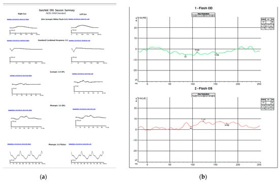 Genes 13 01005 g002 550