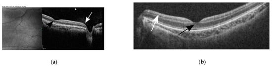 Genes 13 01005 g003 550
