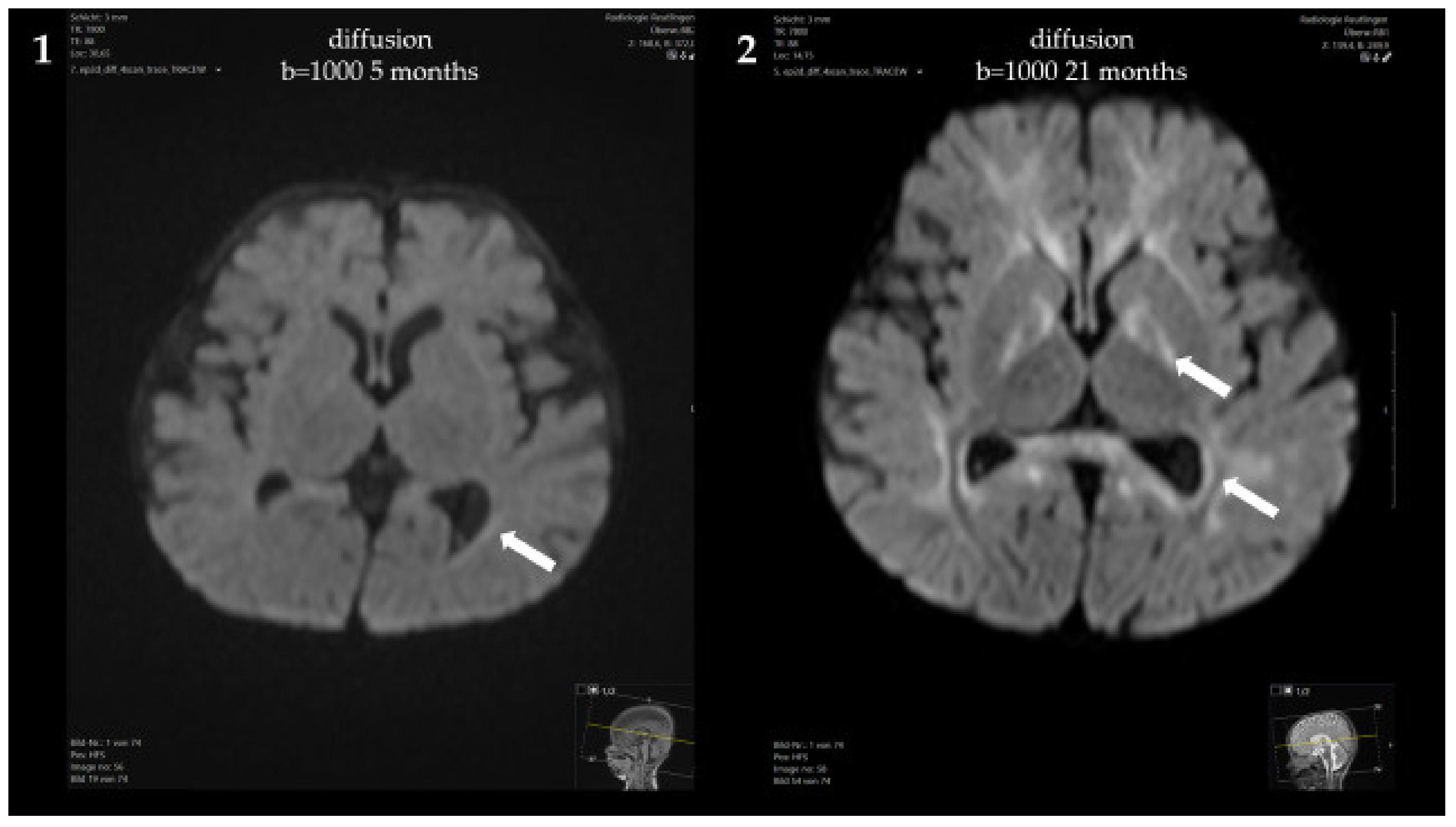 Genes 13 01163 g002a