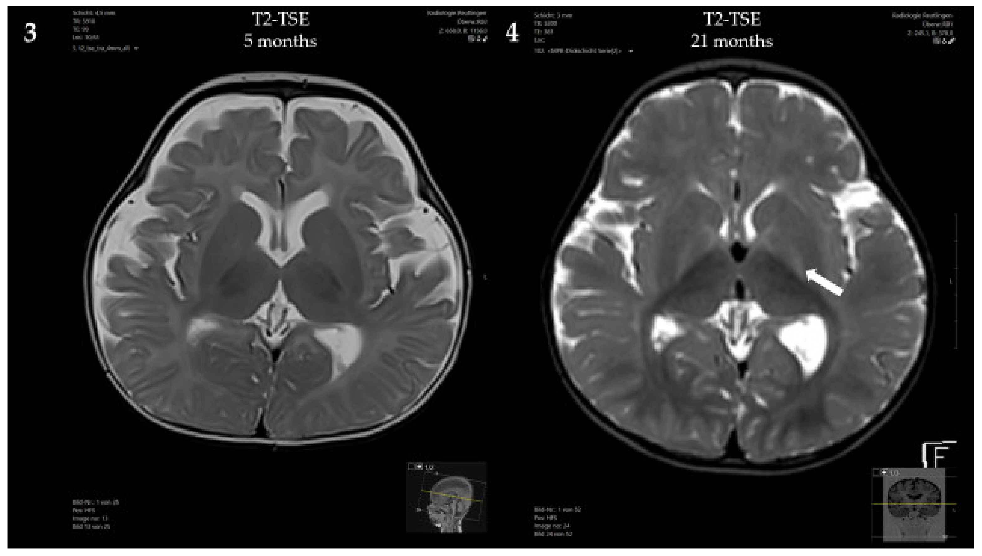 Genes 13 01163 g002b