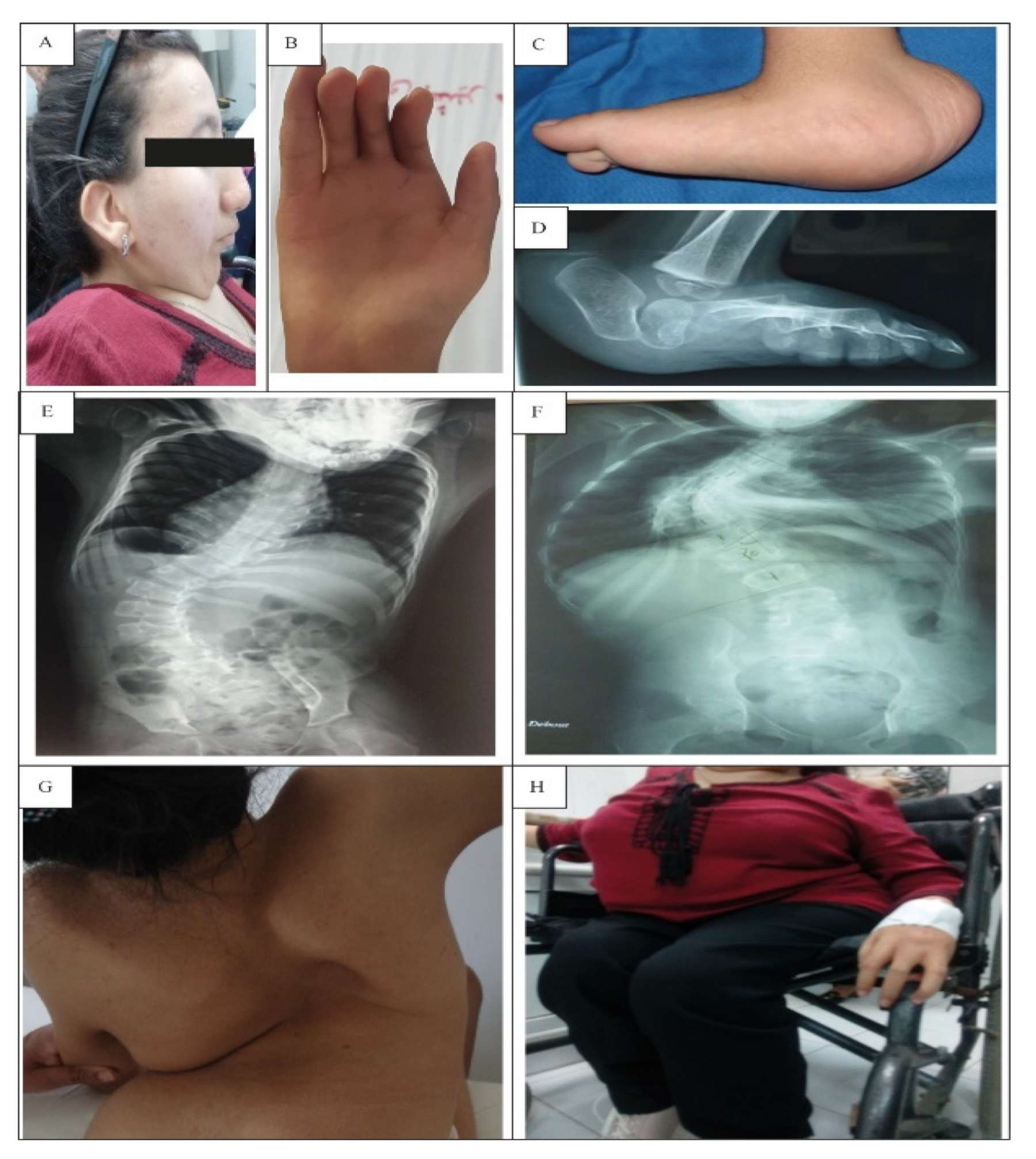 Genes 13 01748 g001 Genes 13 01748 g001