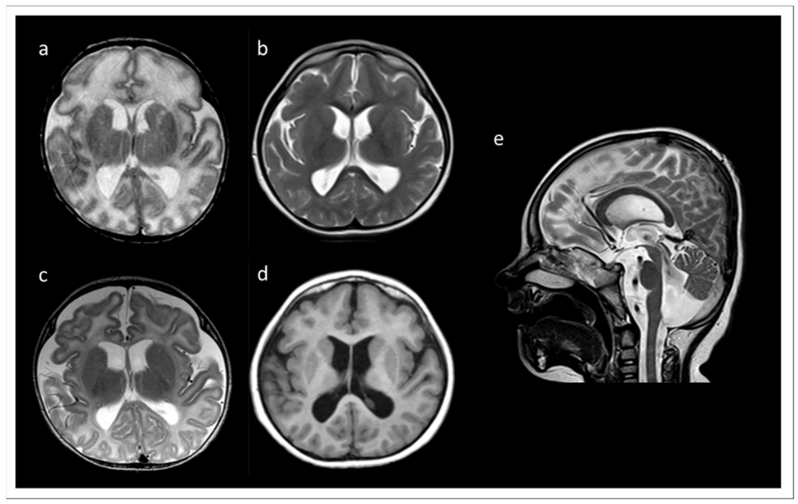 Genes 13 02154 g001 Genes 13 02154 g001