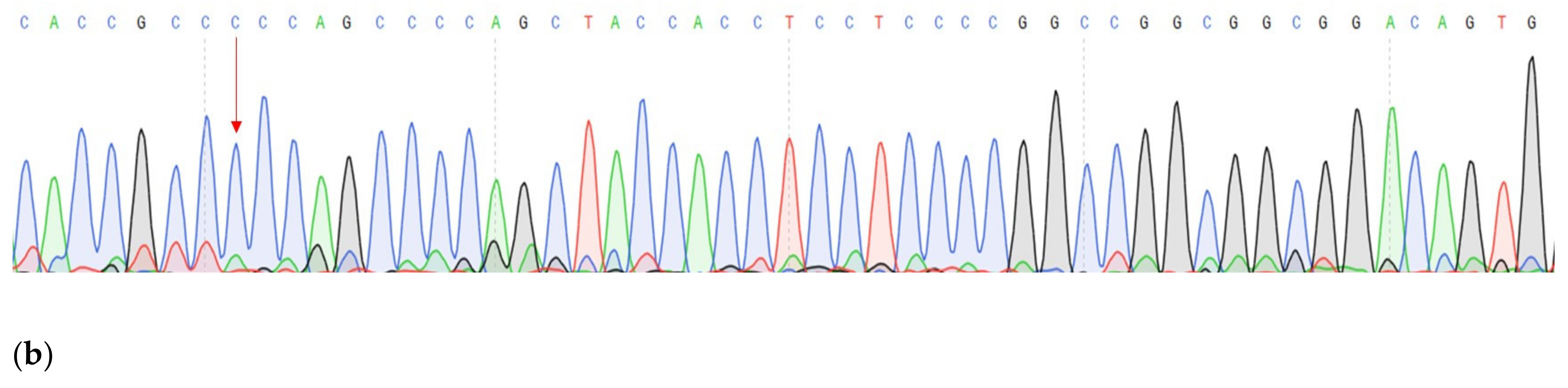 Genes 14 00280 g004b Genes 14 00280 g004b