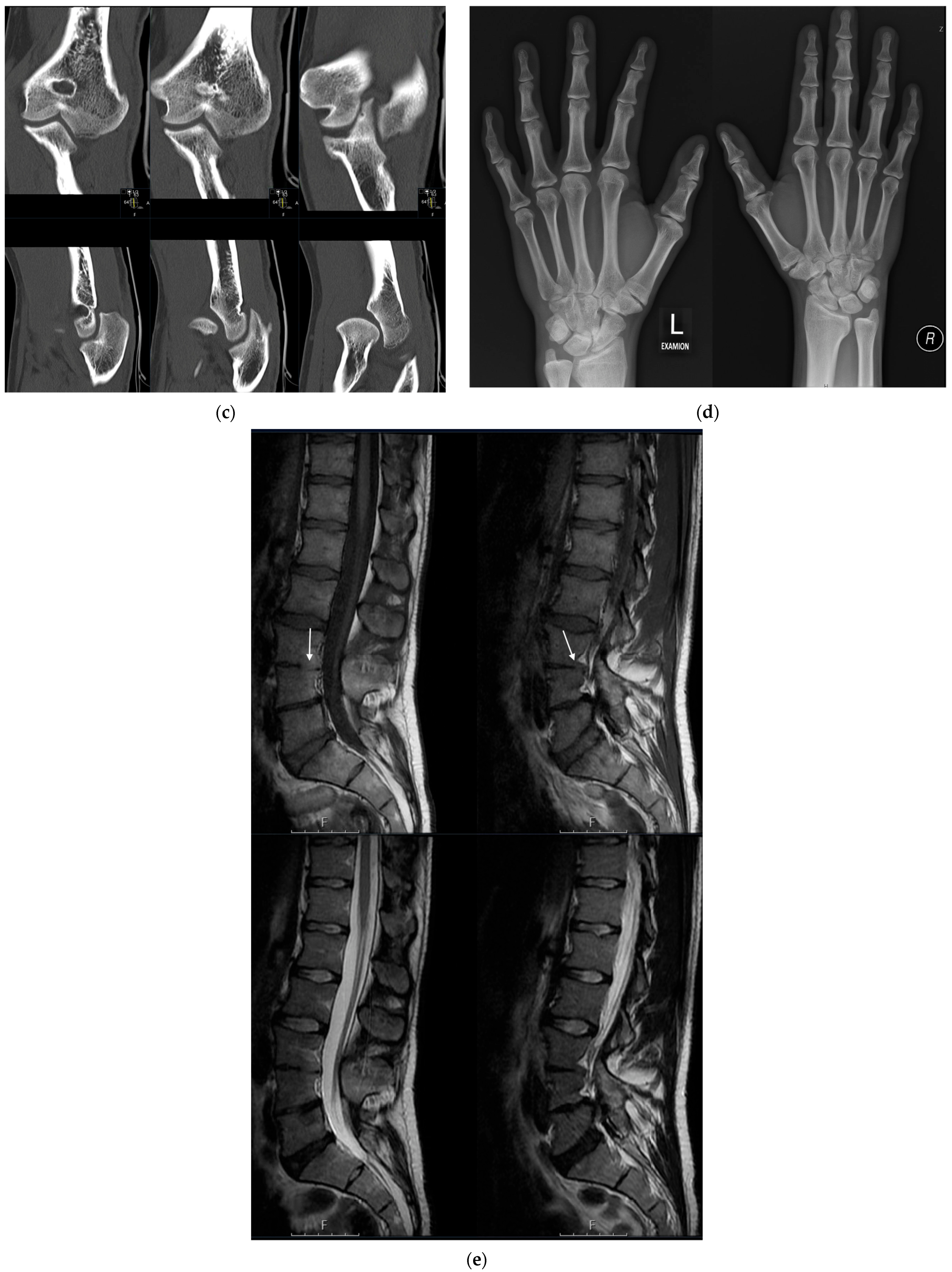 Genes 14 00724 g003b