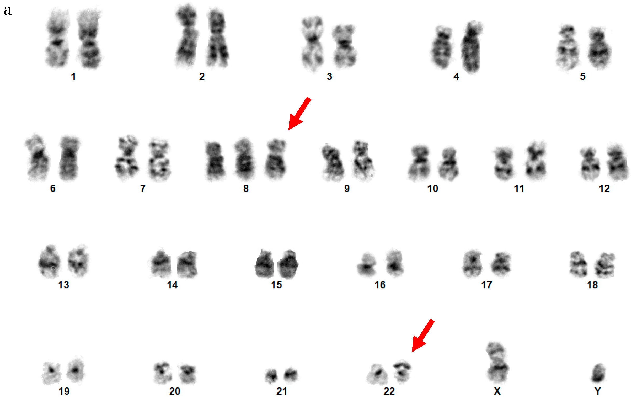 Genes 14 01139 g010a