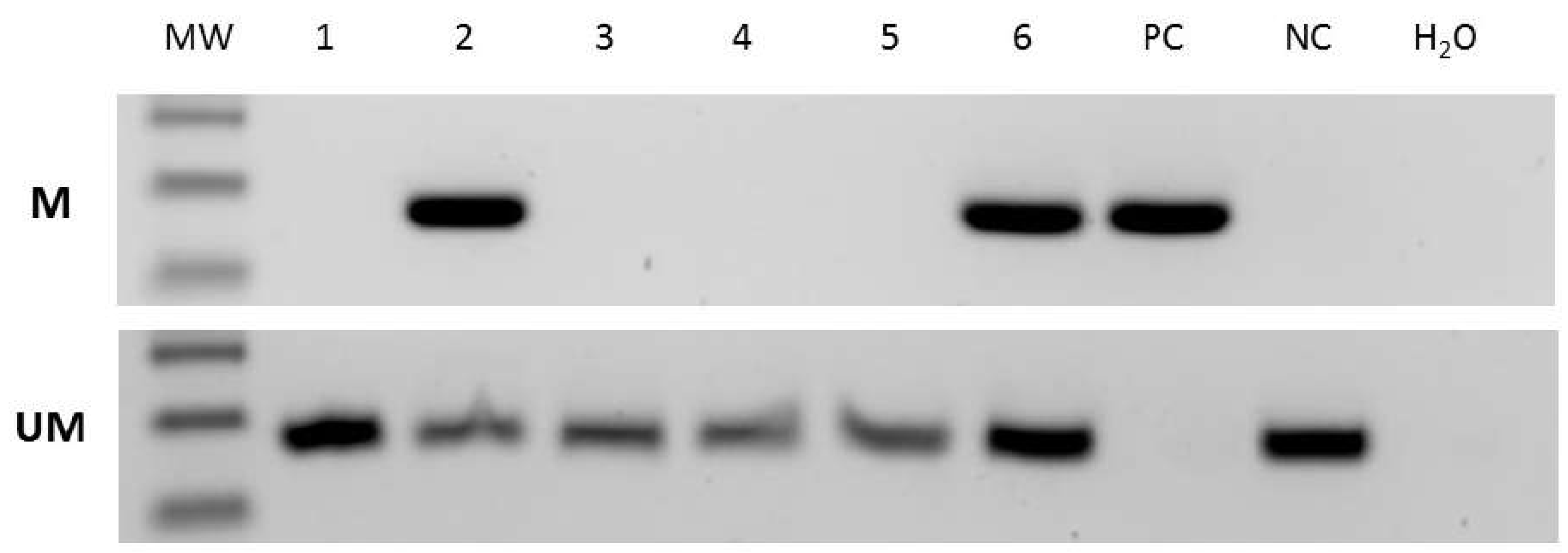 Genes 14 01146 g001