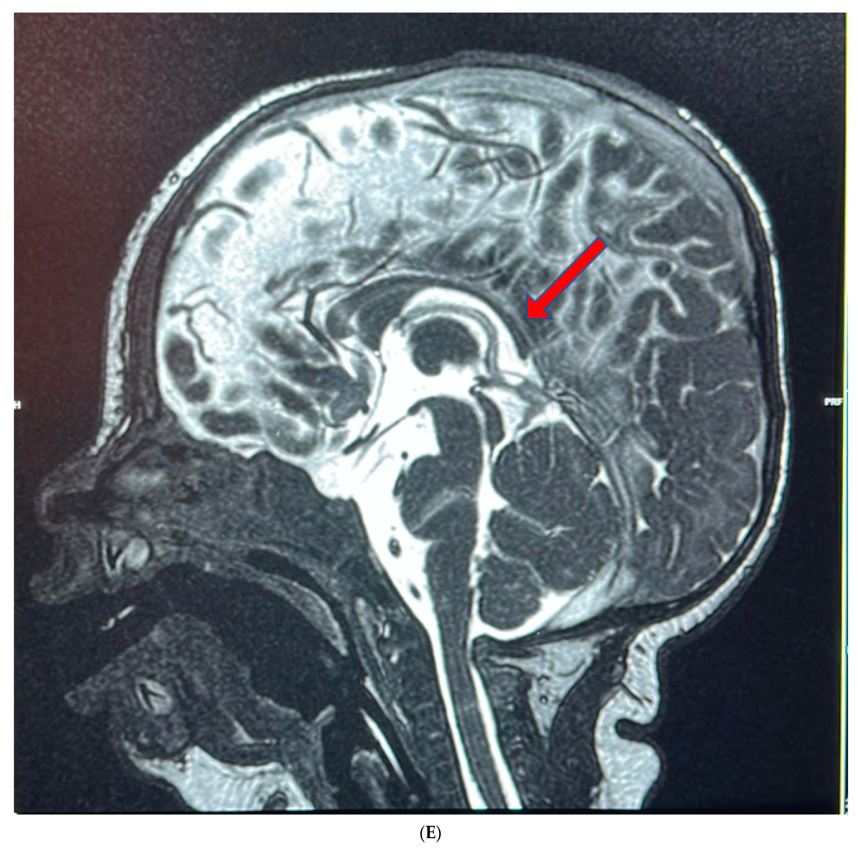 Genes 14 01225 g001b