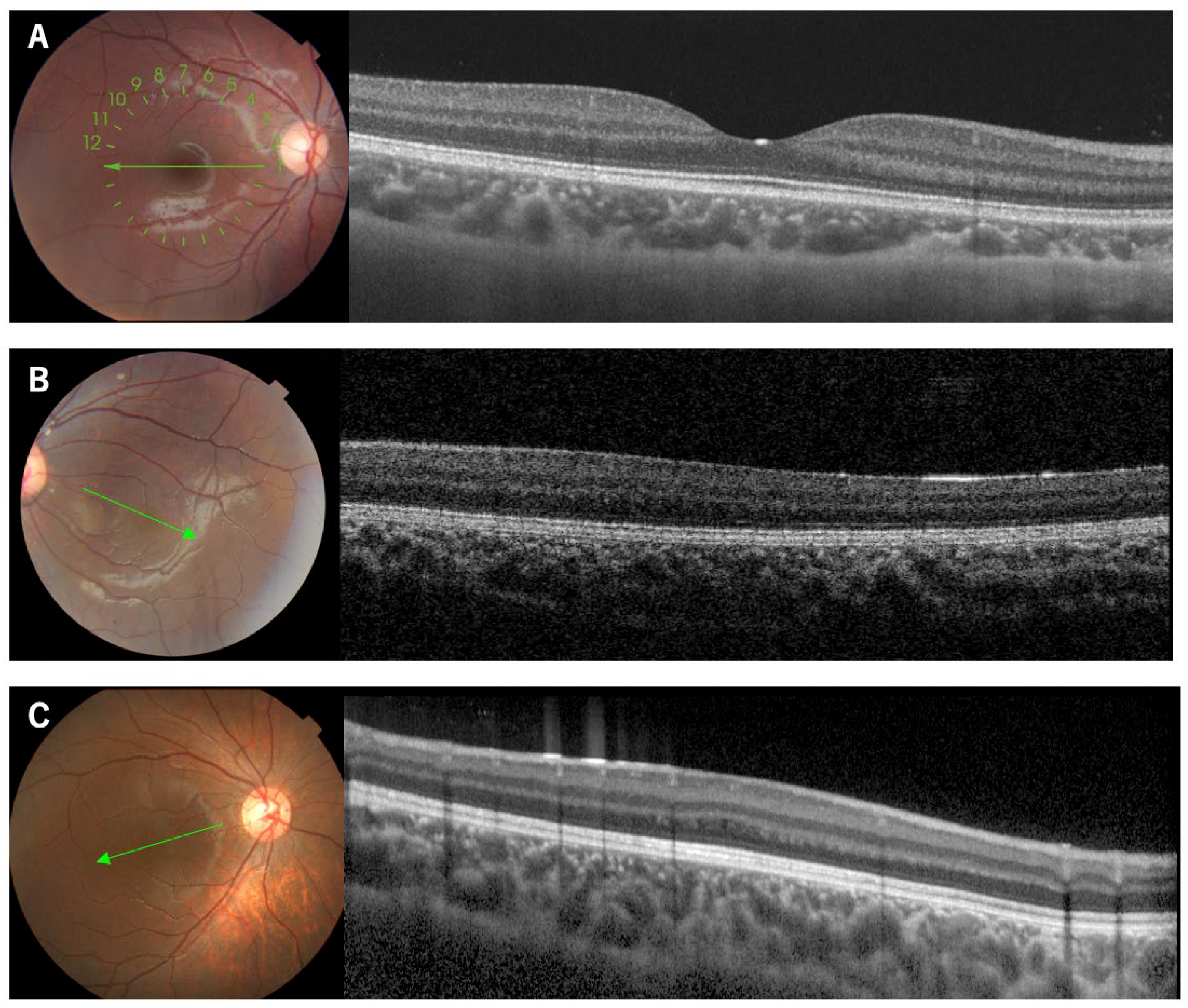 Genes 14 01483 g001 Genes 14 01483 g001