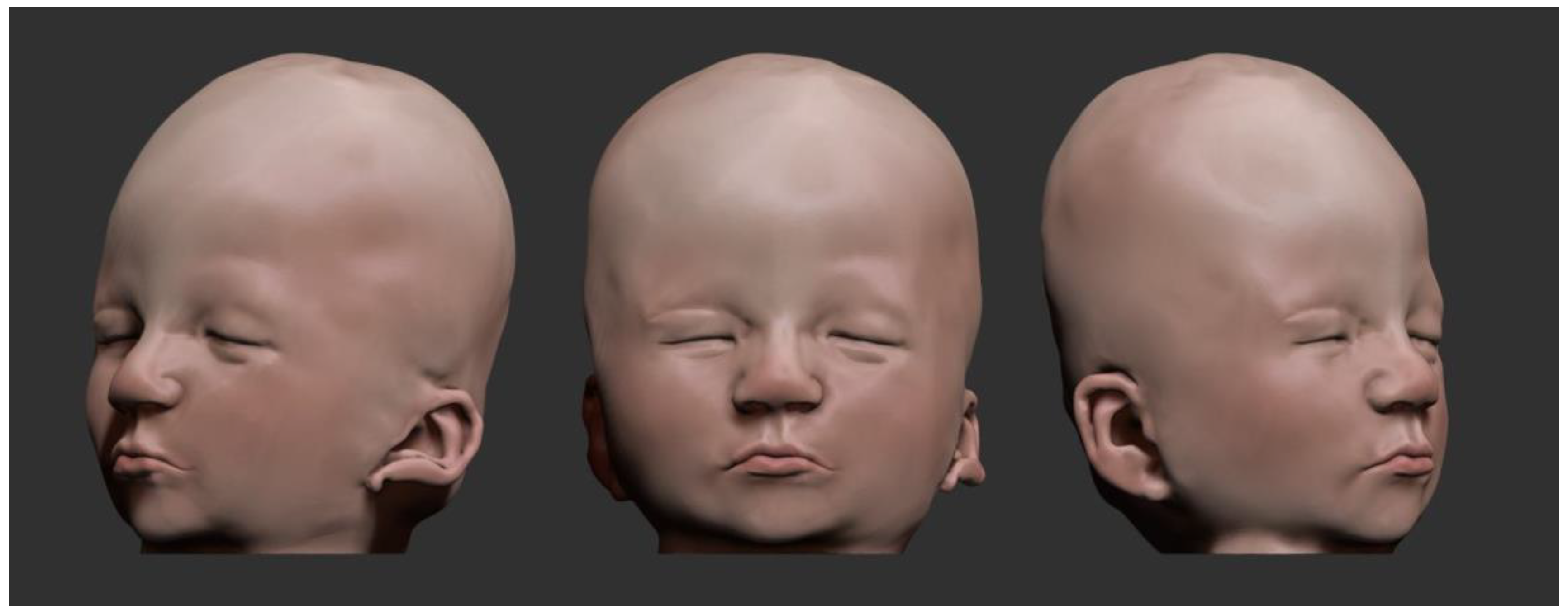 Genes 14 01583 g004 Genes 14 01583 g004